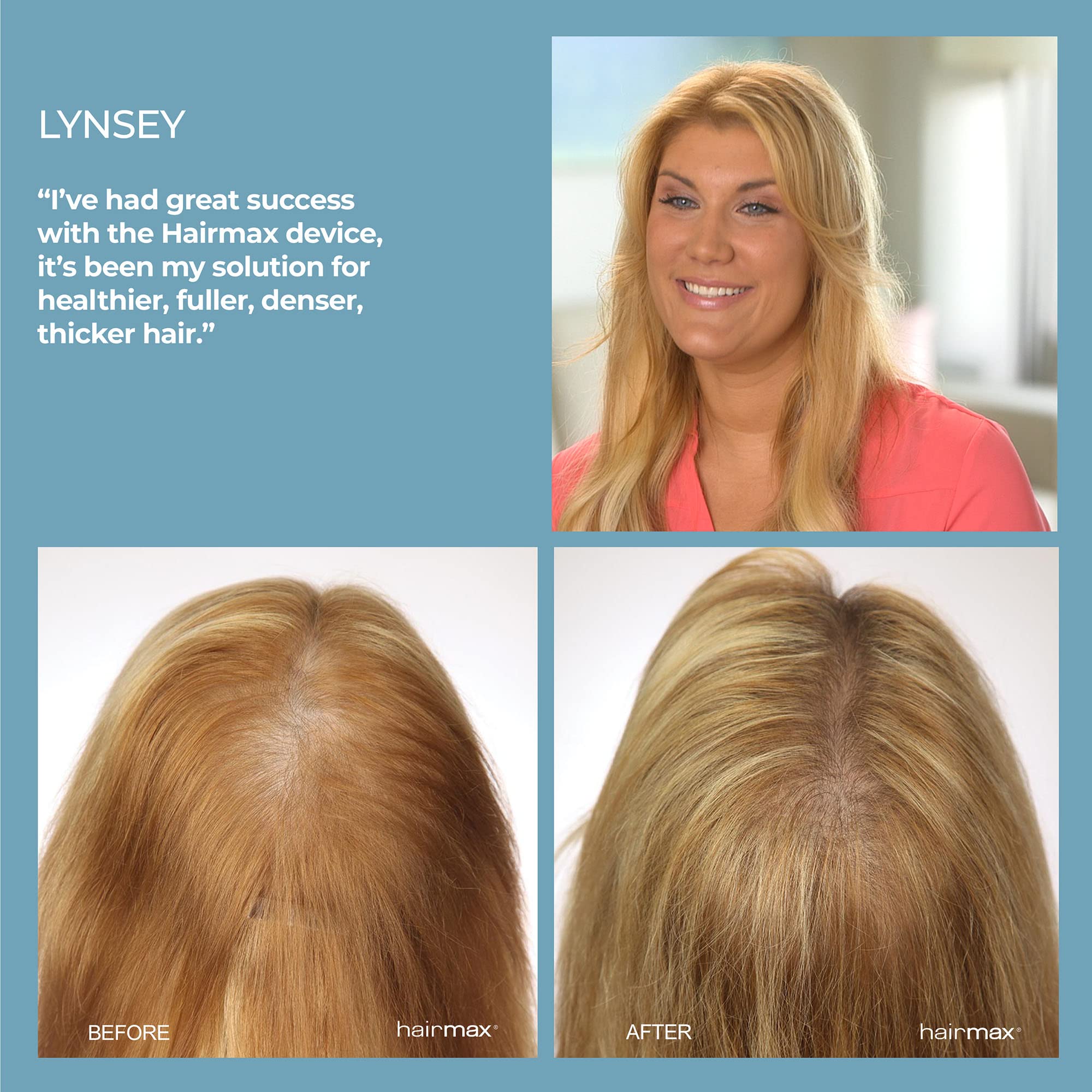 HairMax LaserBand 41 (FDA Cleared). 41 Medical Grade Lasers. Stimulate