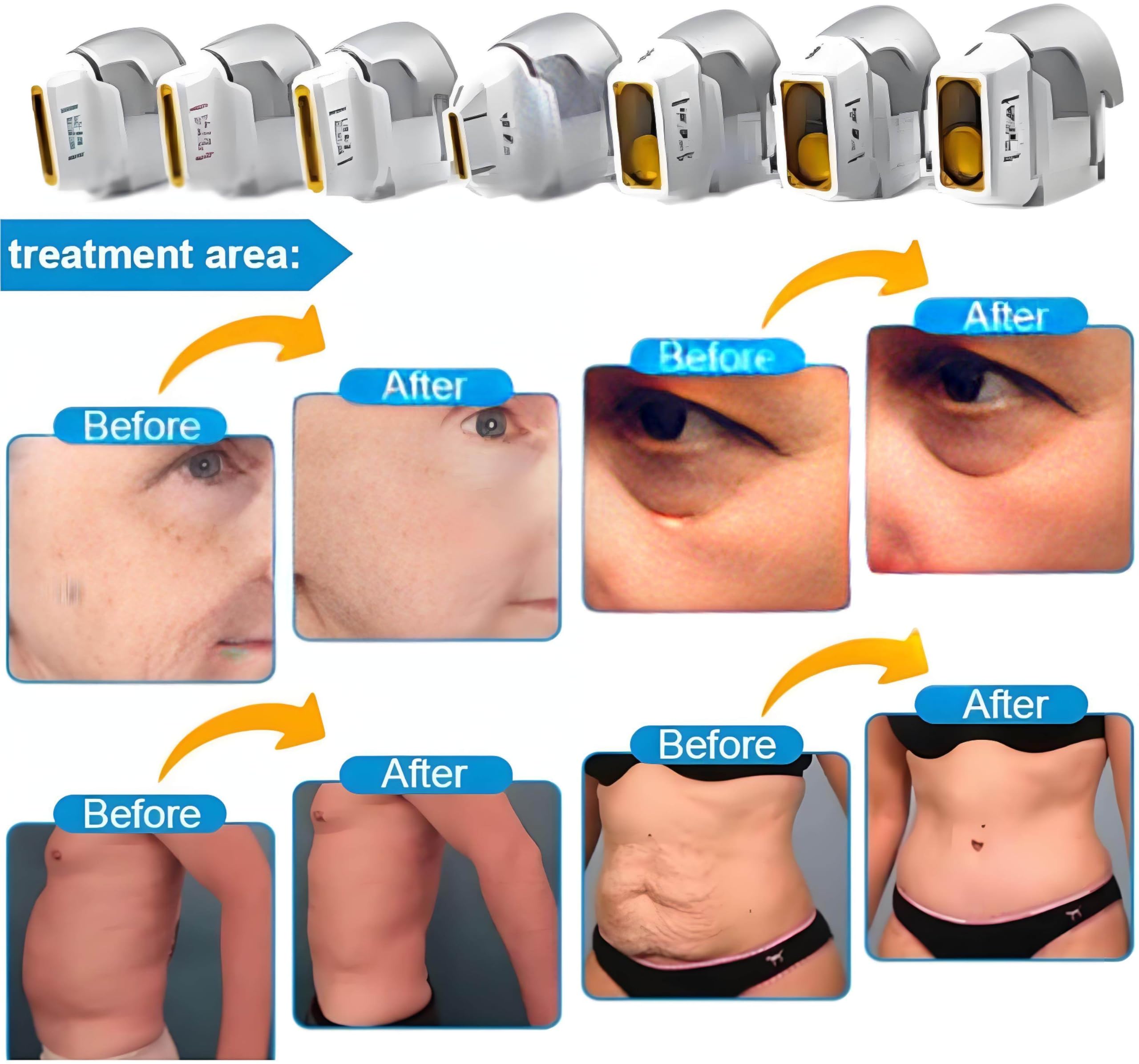 Apparecchio 7 in 1 per rassodare la Pelle Corpo,Apparecchio Lifting Viso, con 7D-Hifu ad Alta intensità,Energia Regolabile per Viso 0,1-2,5J e Corpo 0,1-3,0J,con 2 manipoli Hifu High + 7 sonde