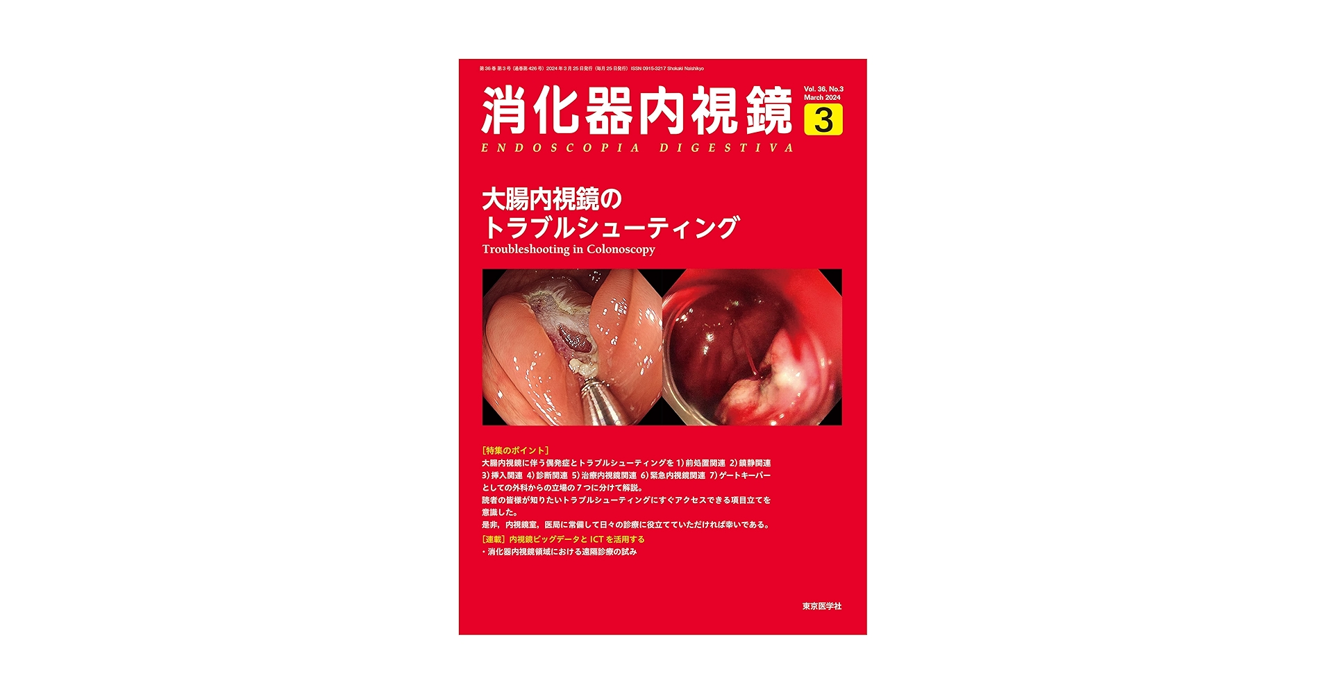 消化器内視鏡36巻3号2024年3月号 大腸内視鏡のトラブル