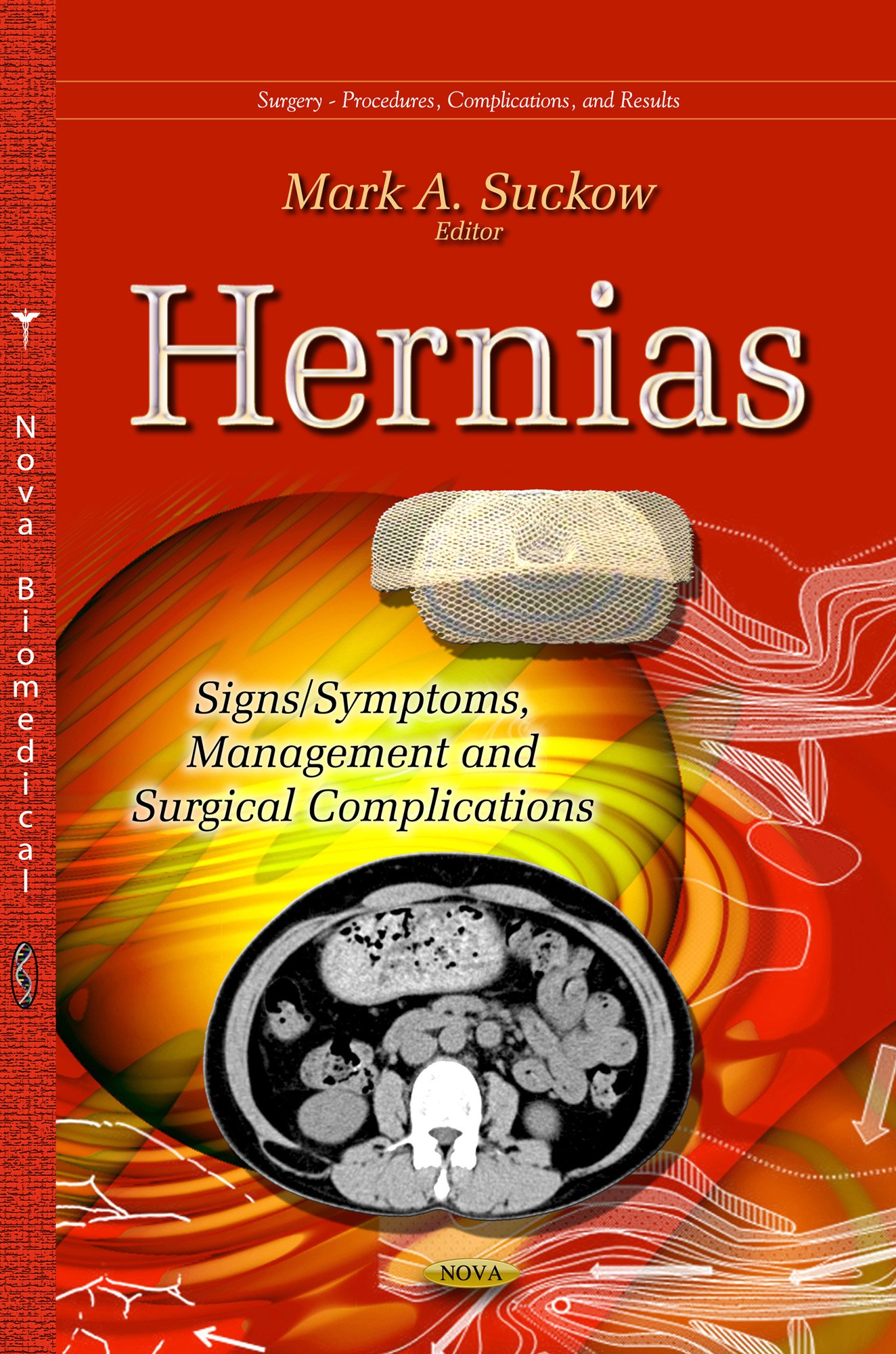 Hernias: Signs / Symptoms, Management & Surgical Complications (Surgery - Procedures, Complications, and Results)