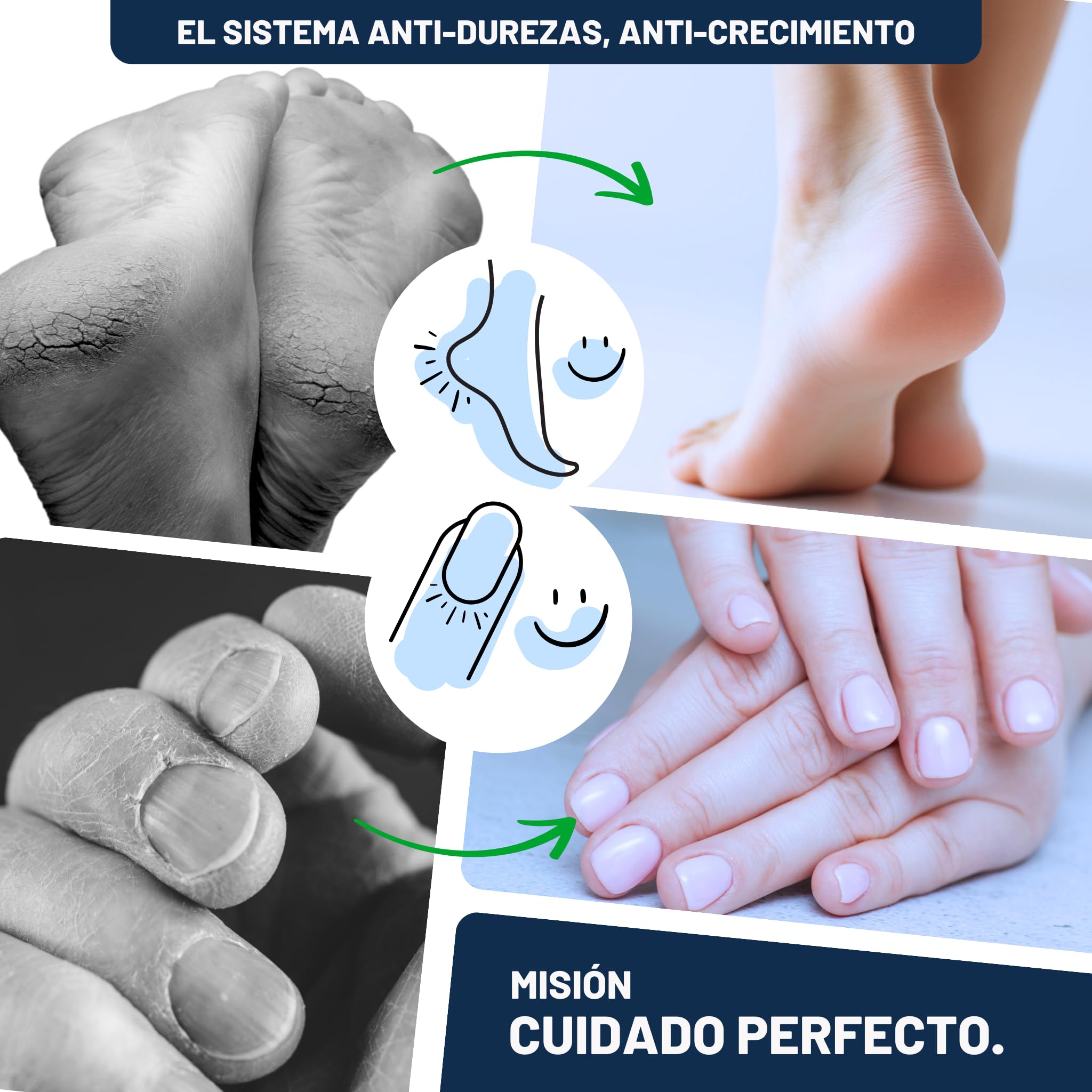 Mr. Fuss® N.º 4 Plus Pack Steel - Eliminador de cutículas y cutículas (3 piezas, solución activa, suavizante rápido, 500 ml, algodón, raspador de acero inoxidable)