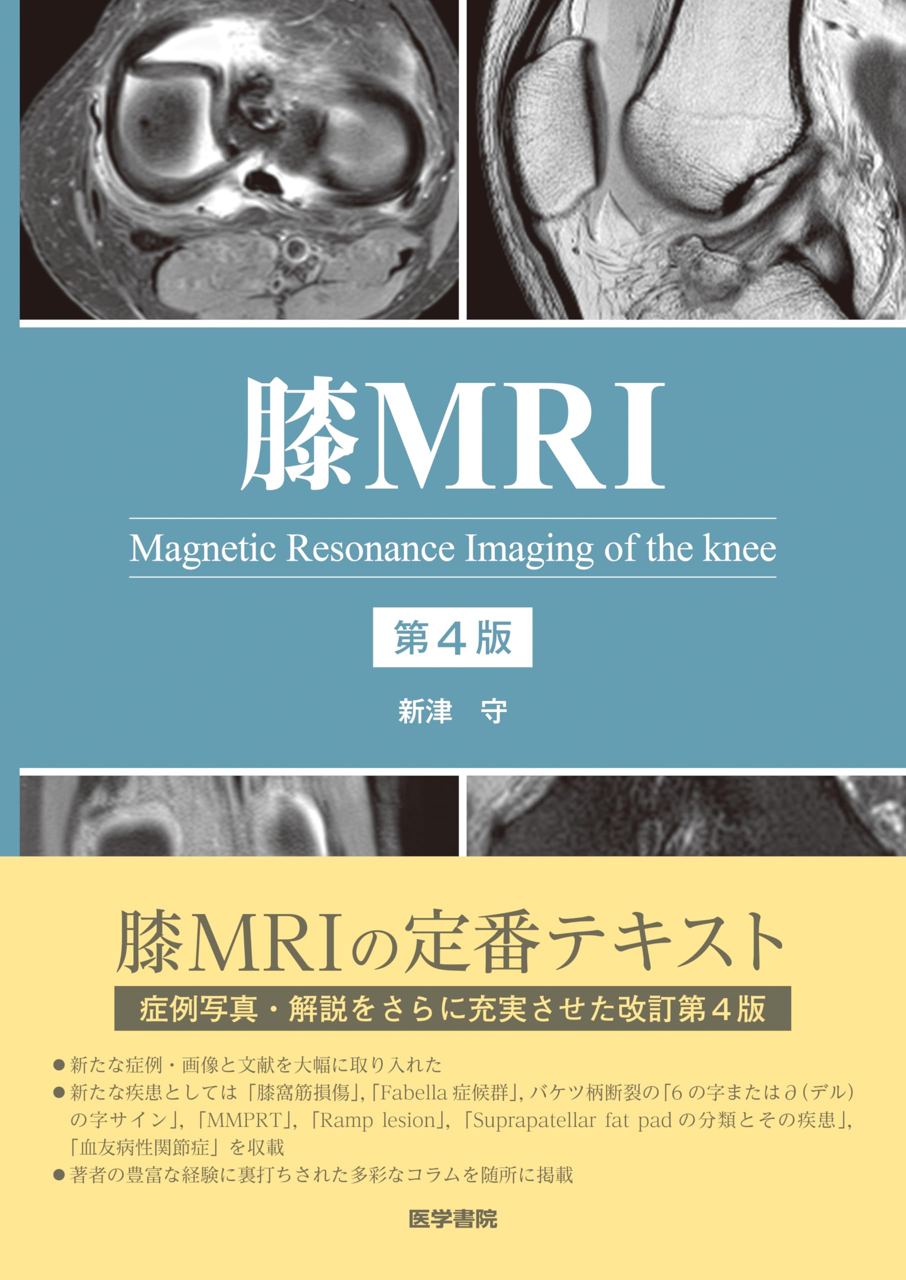 膝MRI 第4版 | 新津 守 |本 | 通販 | Amazon