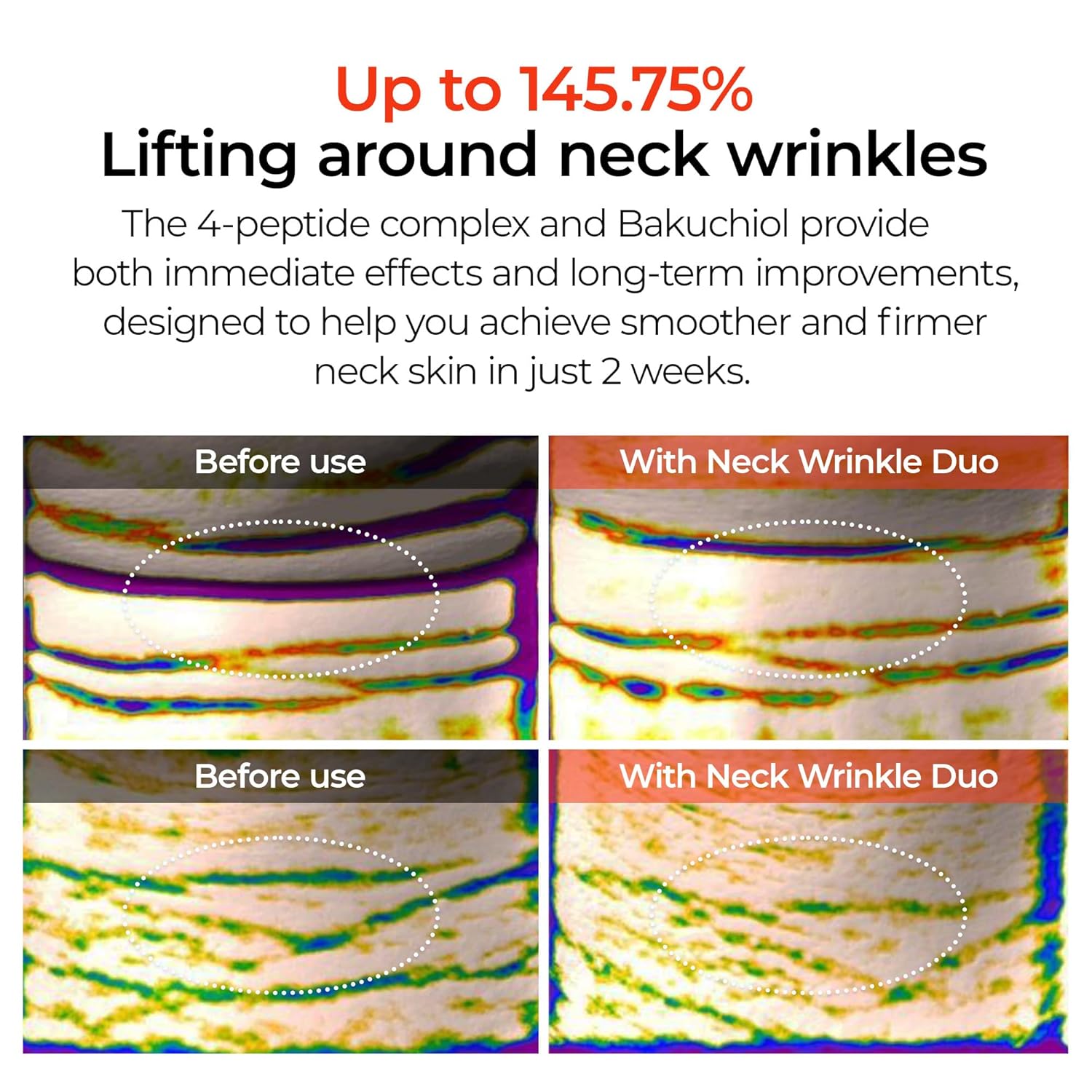 Dr. Melaxin Neck Care Cream Set, Volume Lifting Treatment, Necklinephalt and Necksphalt Formula korean skin care