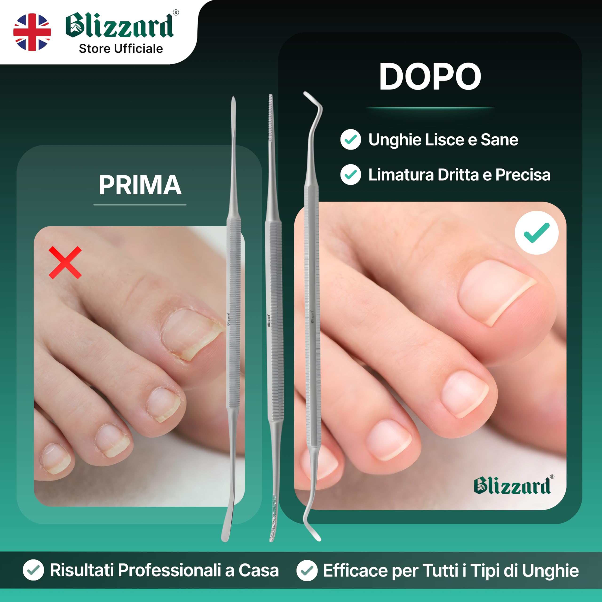 Blizzard Kit Pedicure Professionale 3 Pezzi — Ferri da Podologo per Unghie Incarnite — Set Podologia con Lima, Pulitore e Sollevatore — Acciaio Inox — Per Anziani e Uomo