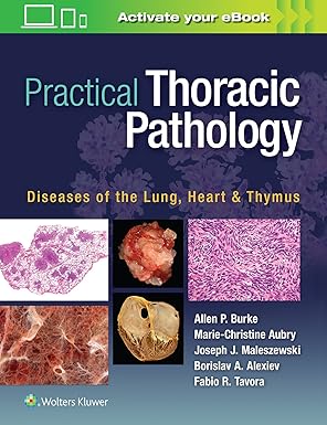 Practical Thoracic Pathology Diseases Of The Lung Heart And Thymus (Hb 2017)