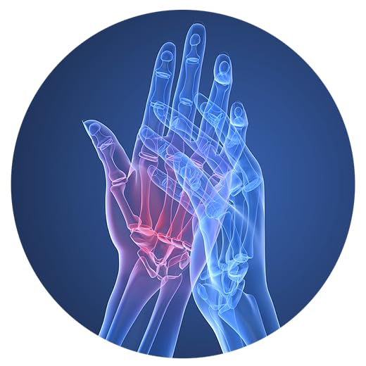 Cure for Rheumatoid Arthritis