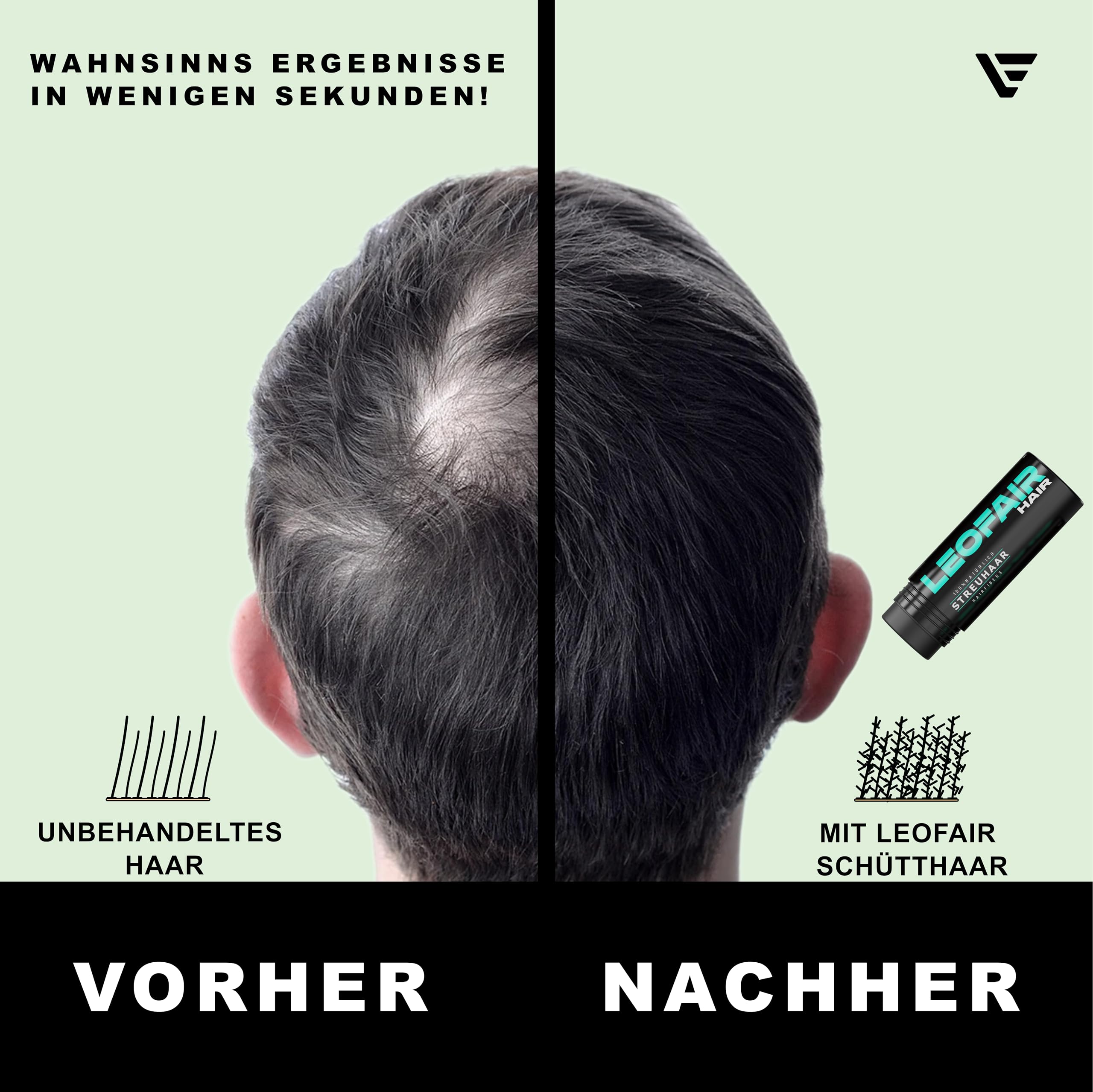 Haarverdichtung - 100% natürlich - Streuhaar für volles und dichtes Haar in Sekunden! Schütthaar in Premium Friseurqualität - 28g - Perfekter Look für Männer & Frauen (Dunkelbraun)