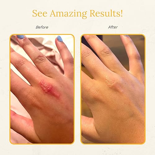 Miniatura 5 de Rejuvaskin Crema para recuperación de la piel crema para aliviar la radiación crema para la piel con glucosamina caléndula ácido hialurónico aloe