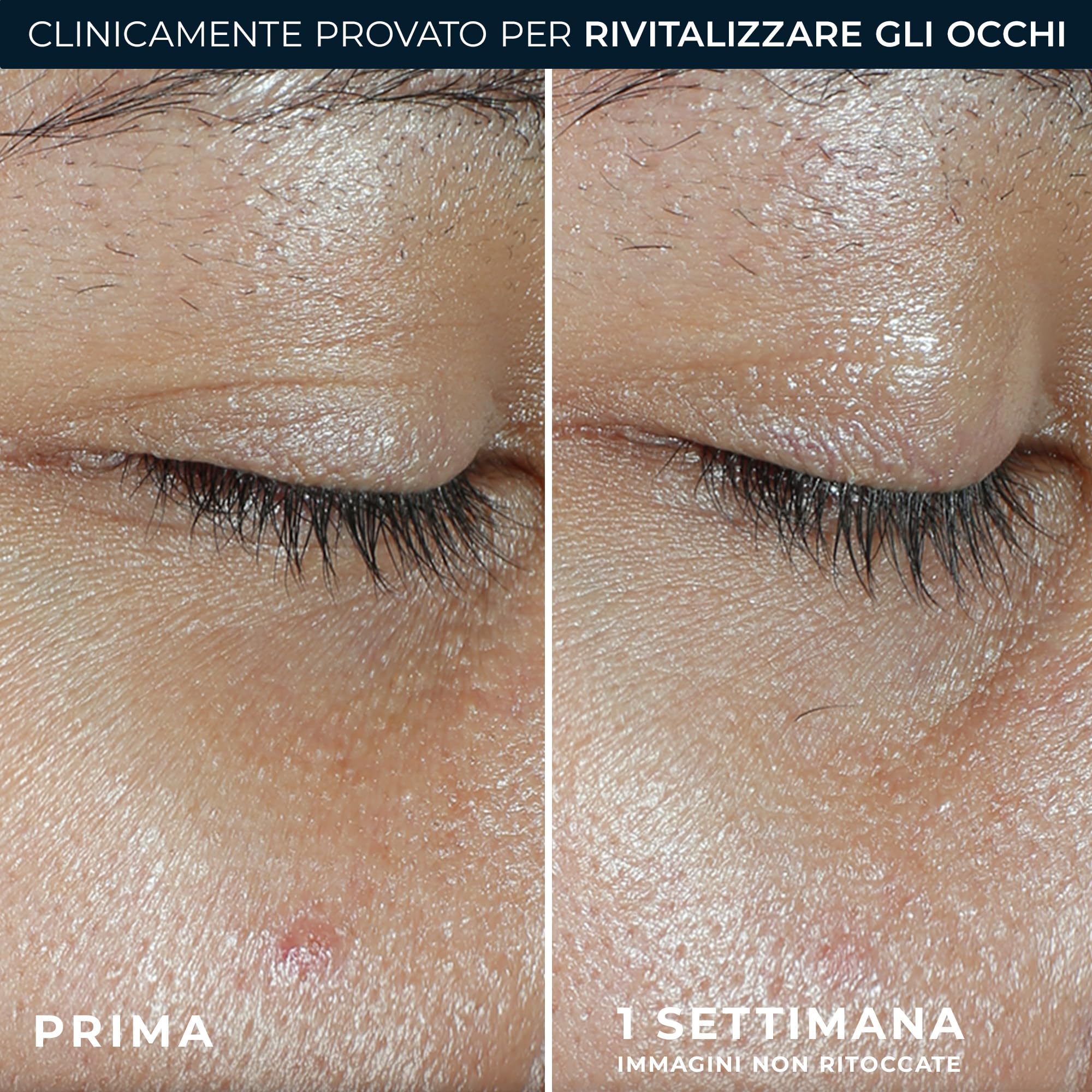 RoC - Multi Correxion Revive + Glow Balsamo Occhi - Formula Alla Vitamina C E Ai Peptidi - Riduzione Delle Cricche Scure E Delle Borse - Applicazione Senza Contatto - Ipoallergenico - 4g