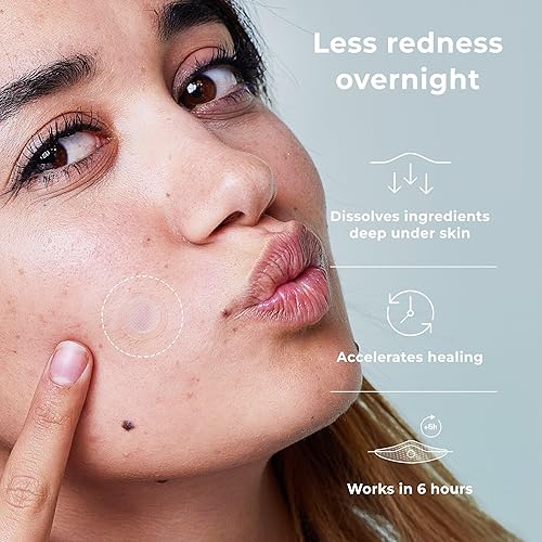 Miniatura 3 de OMMA Micropoint - Parche para acné quístico | Parches eficientes para espinillas con microagujas, parches de manchas oscuras para granos dolorosos