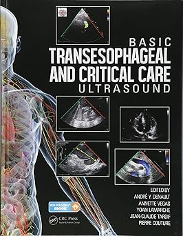Basic Transesophageal And Critical Care Ultrasound (Pb 2018)