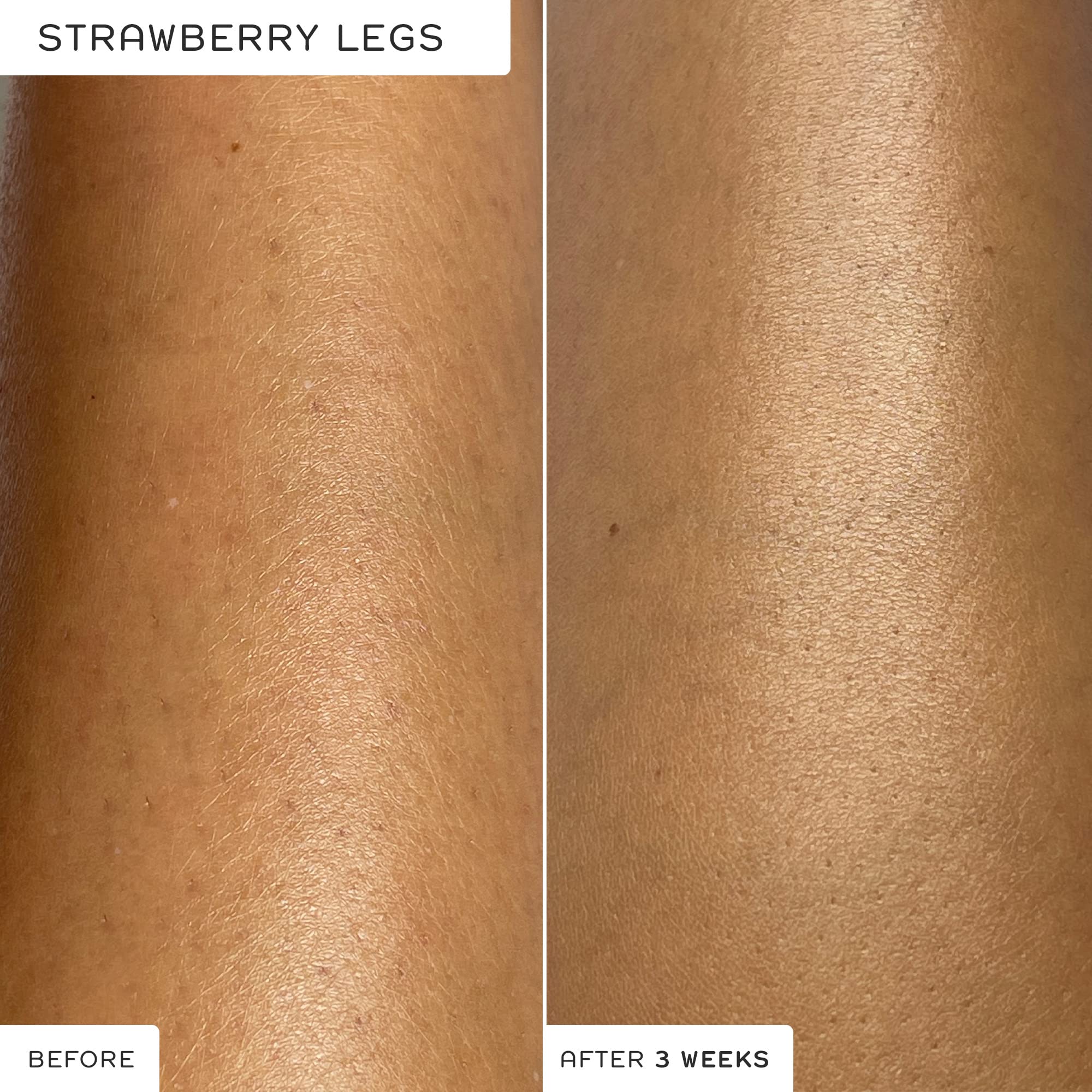 Buy REN Clean Skincare AHA Body Serum Lactic Acid for Gentle