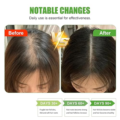 Miniatura 3 de Aceite de batana 100% crudo, aceite milagroso puro y sin refinar con manteca de karité, vitamina E y aceite de semillas de ricino, sin fragancia,