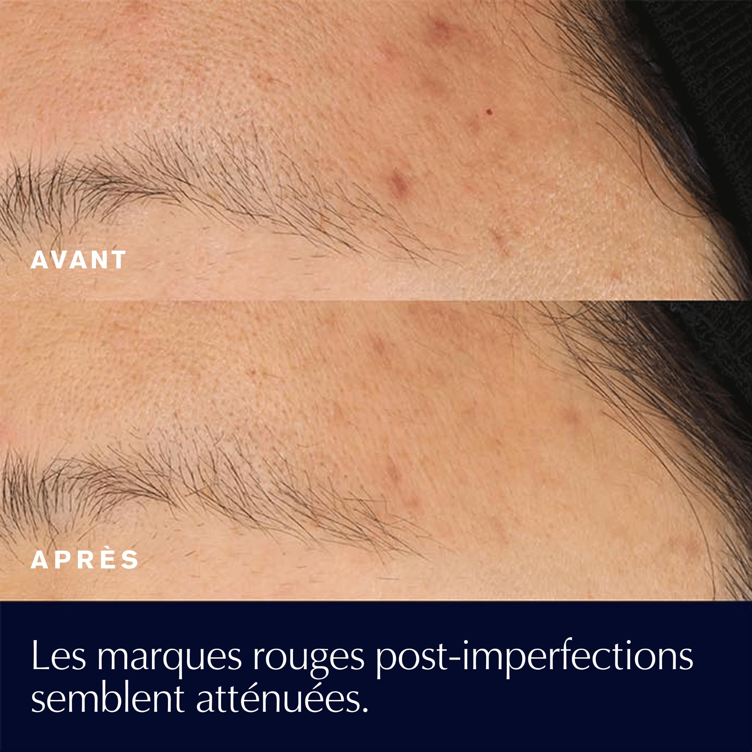 Estée Lauder Advanced Night Repair Concentré Apaisant Avec 15% de Ferment Bifidus | Sérum Visage Apaisant Peaux Sensibles | Réduit les Rougeurs, 20ml