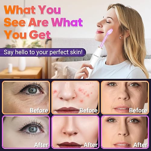 Miniatura 4 de Varita de alta frecuencia - Máquina de dispositivo facial de alta frecuencia UUPAS con 4 tubos