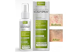 Folliculitis Scalp Spray for Healthy Hair