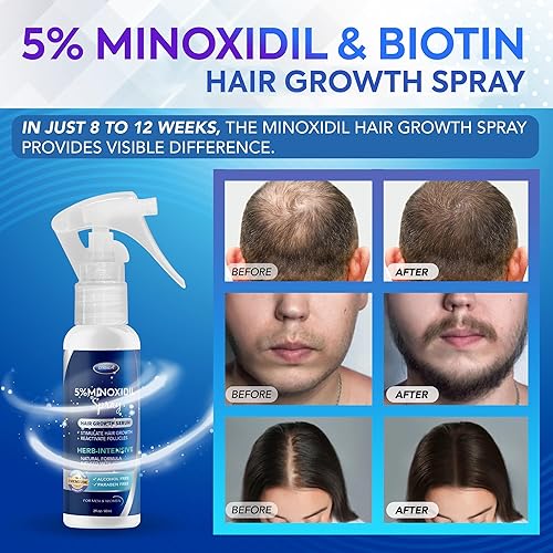 Miniatura 2 de Spray de crecimiento del cabello de minoxidil al 5 % Minoxidil para mujeres, tratamiento para el crecimiento del cabello, minoxidil al 5 por ciento