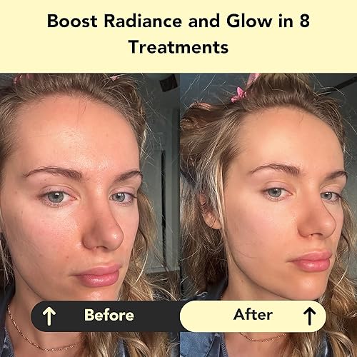 Miniatura 9 de Glorio Máscaras de arcilla limpiadoras desintoxicantes con ácido salicílico  8 tratamientos sellados individualmente más aplicador  Desobstruye los