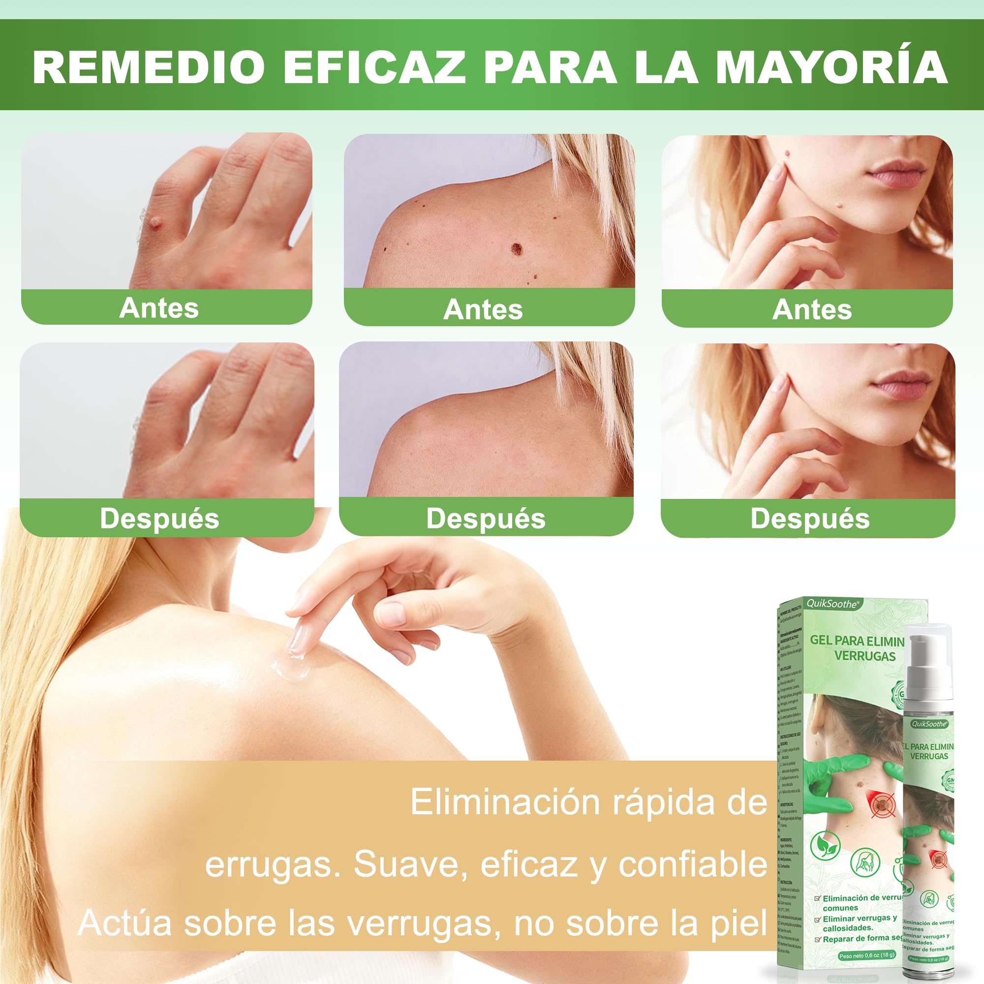 Gel para Quita Verrugas (Quita Verrugas)