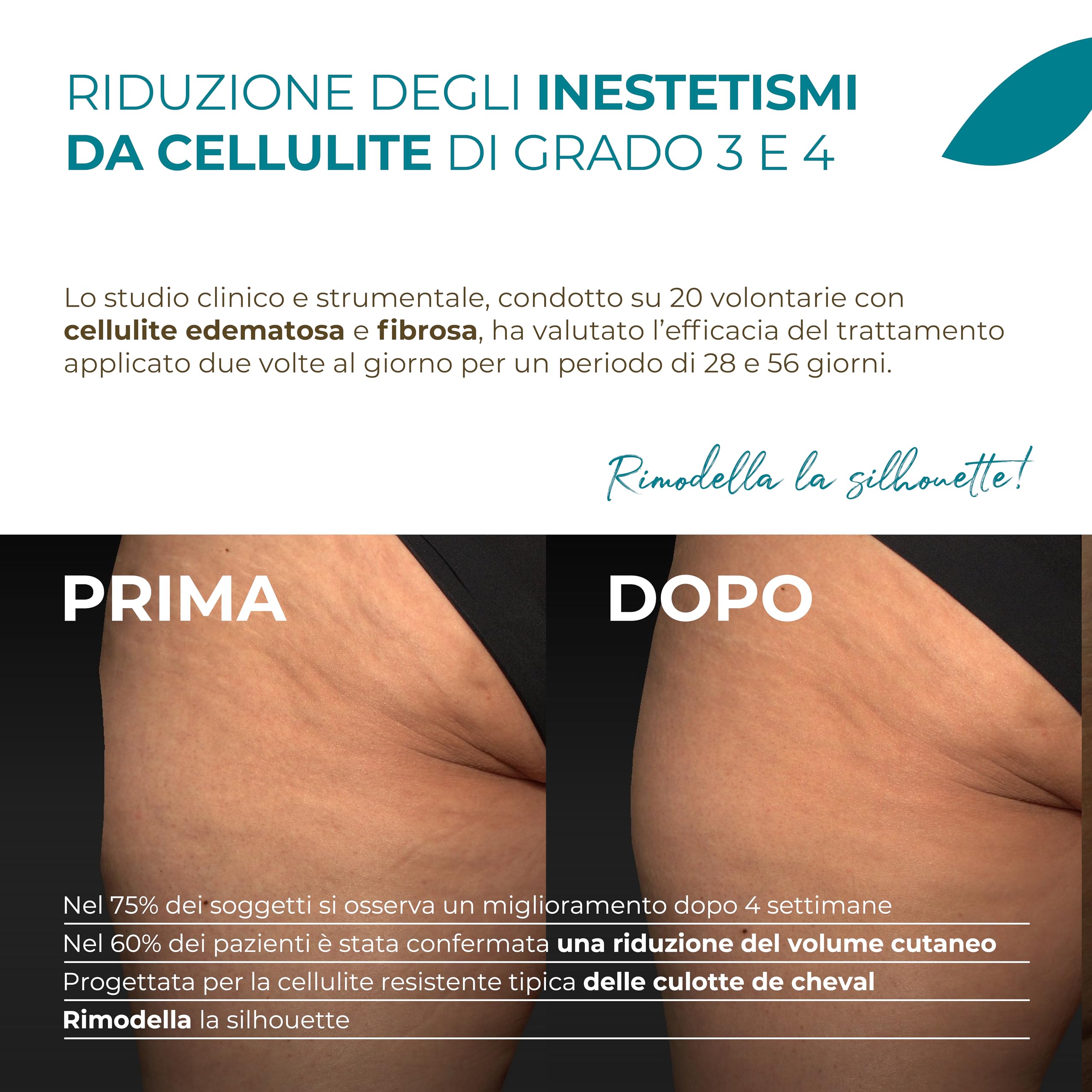 Iodase Crema Cellulite Culotte de Cheval 200ml, Clinicamente Testata con Actisom®, Escina e Caffeina, Migliora Compattezza, Microcircolo e Drenaggio, Riduce Volume Cutaneo, Pelle Tonica e Snellita