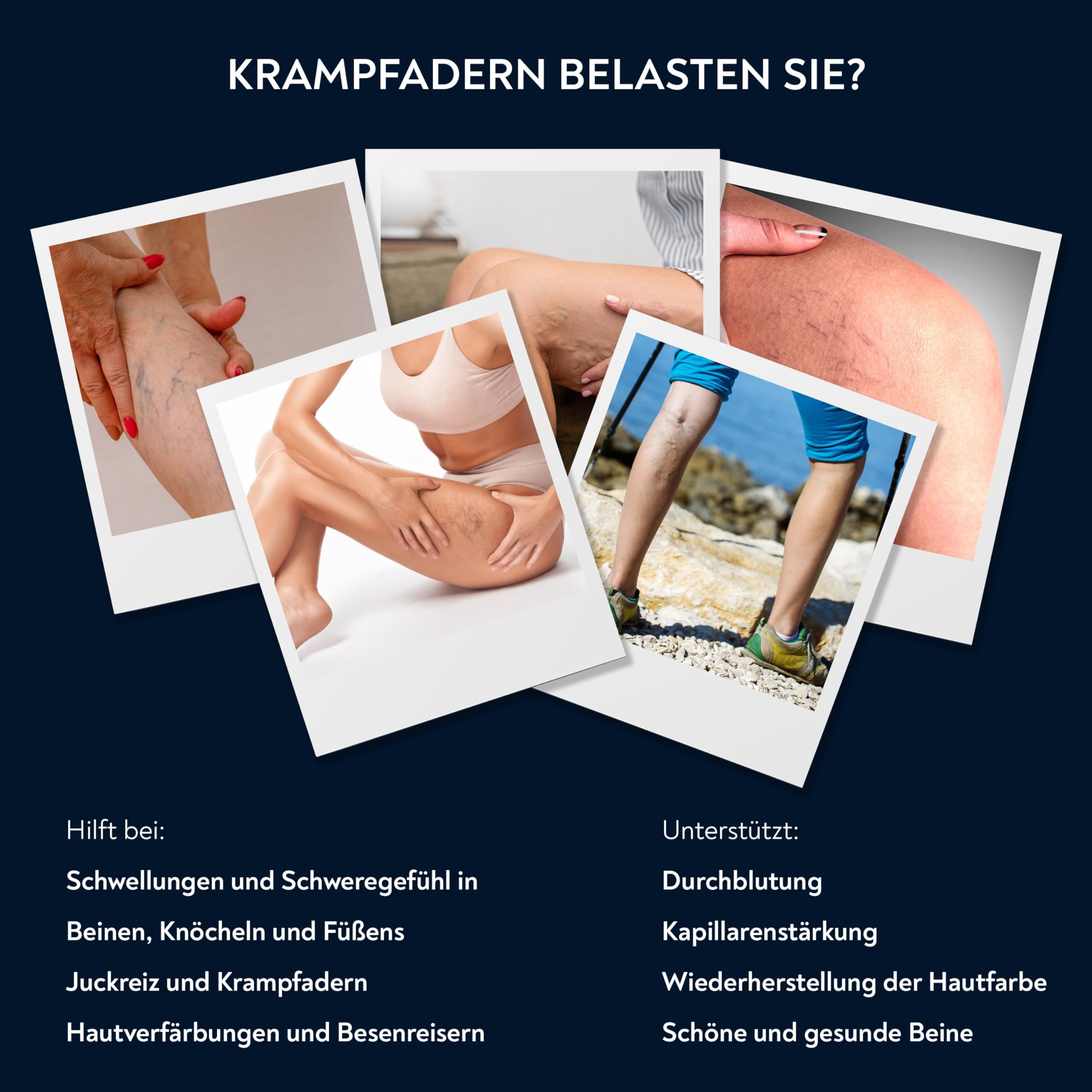 PENIKOSETE Venenpflegecreme | Ayurvedische Formel gegen Besenreiser & Krampfadern | Mit Ashwagandha | Dermatologisch getestet | Nicht klebrig