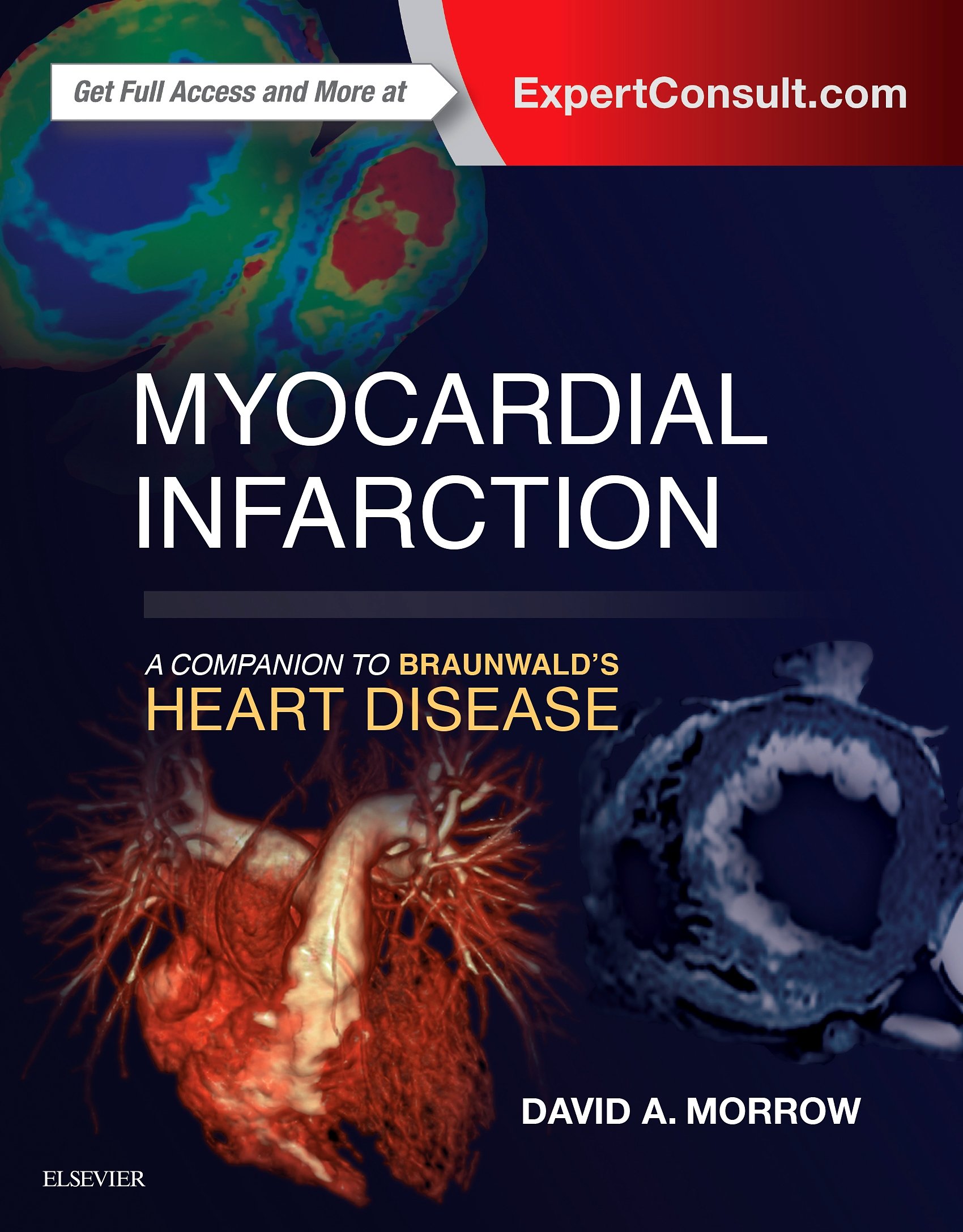 Amazon | Myocardial Infarction: A Companion to Braunwald's Heart