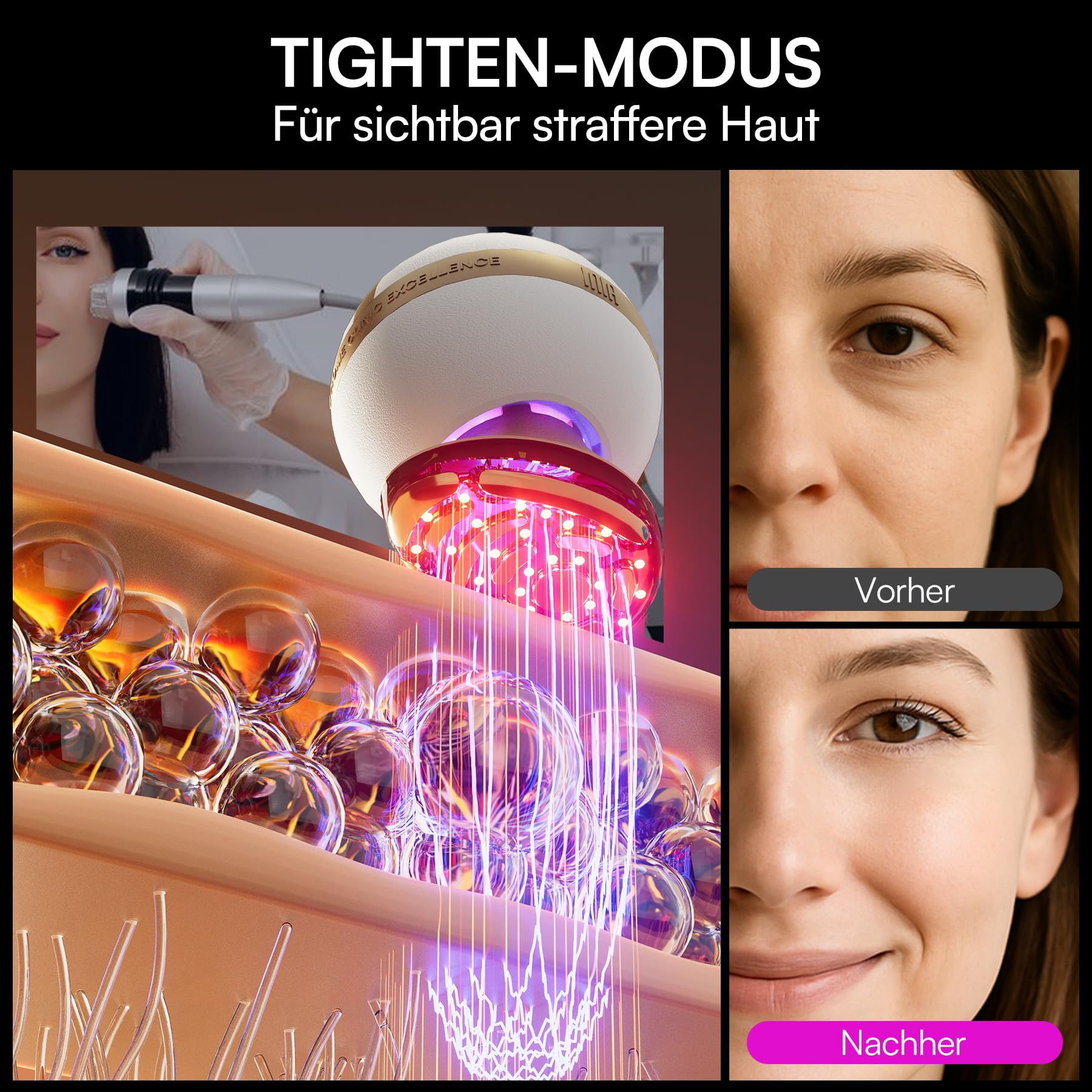 INIA SPHERA Verbesserter 8-in-1 Mikrostrom-Gesichtsmassager für Gesicht & Hals – Rotlicht, Wärme- & Kühlfunktion, 5 Modi, Beauty-Tool für definierte und strahlende Haut zu Hause