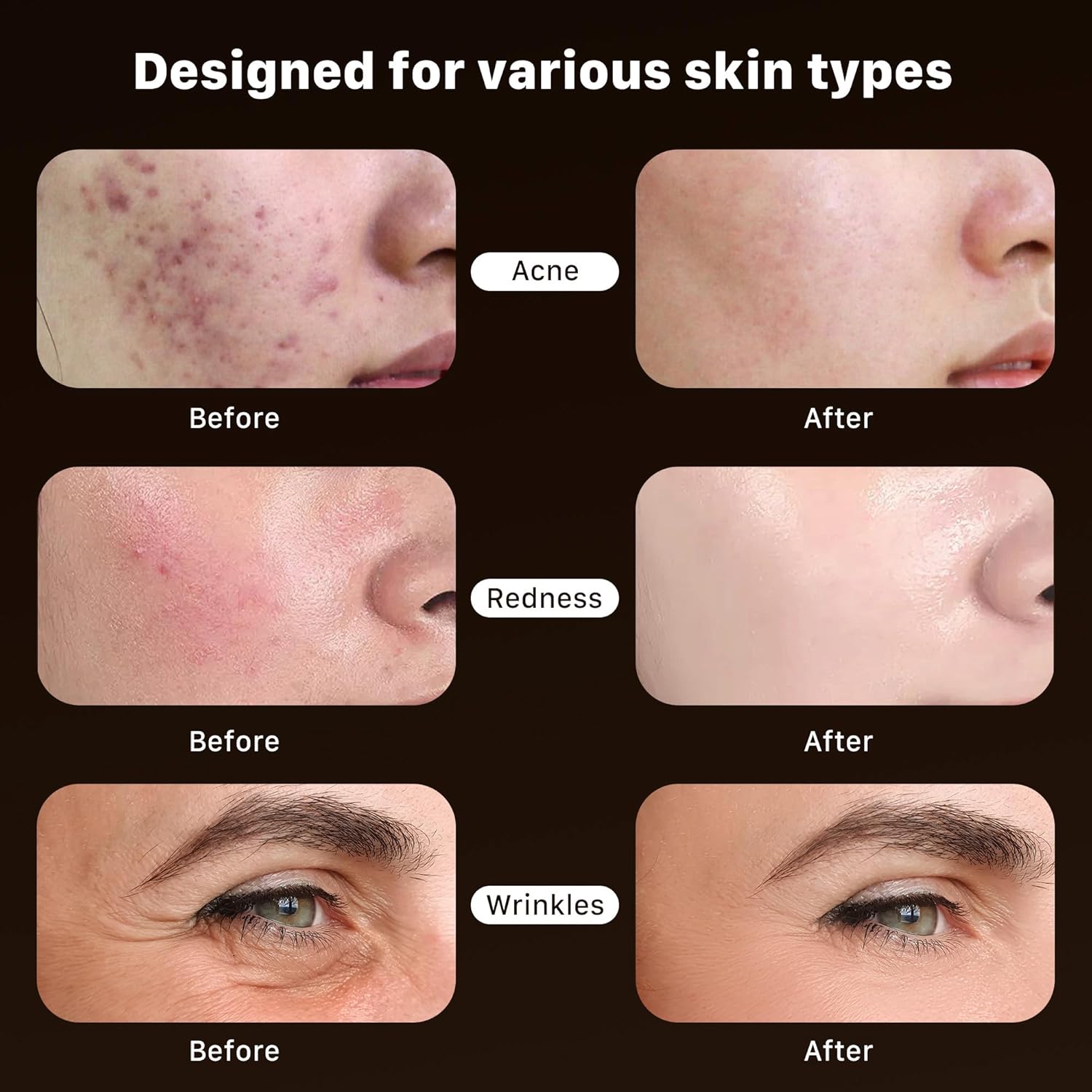 Red Light Therapy for Face, Near-infrared Led Face Mask Light Therapy with Remote, 3 Modes, 850nm Red Light Mask with Timing Function, Portable Led Light Therapy At Home 180 LED Beads - Image 3