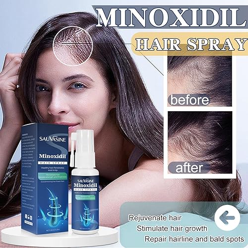 Miniatura 9 de 5% Minoxidil Spray para el crecimiento del cabello para mujeres y hombres tratamiento anti pérdida de cabello para el crecimiento del cabello