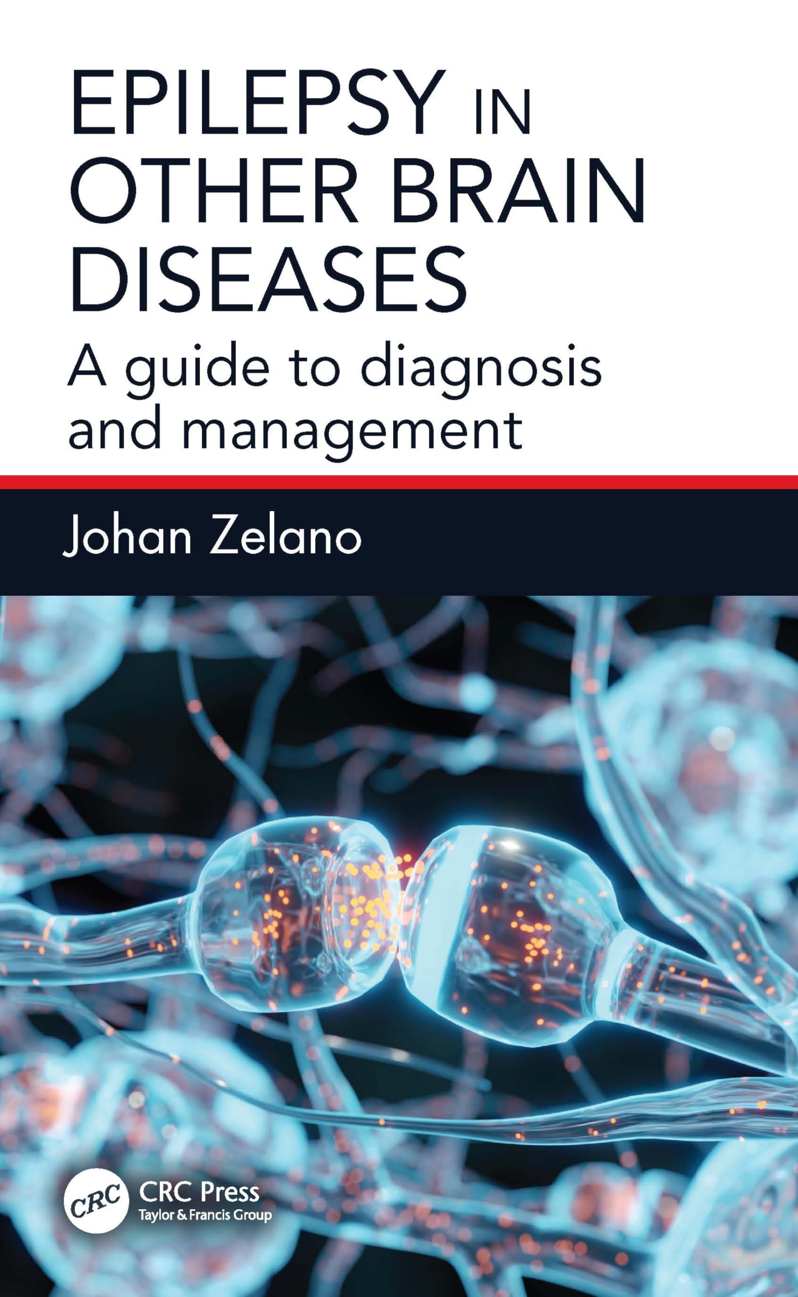 Epilepsy in Other Brain Diseases by Johan Zelano (Paperback Book)