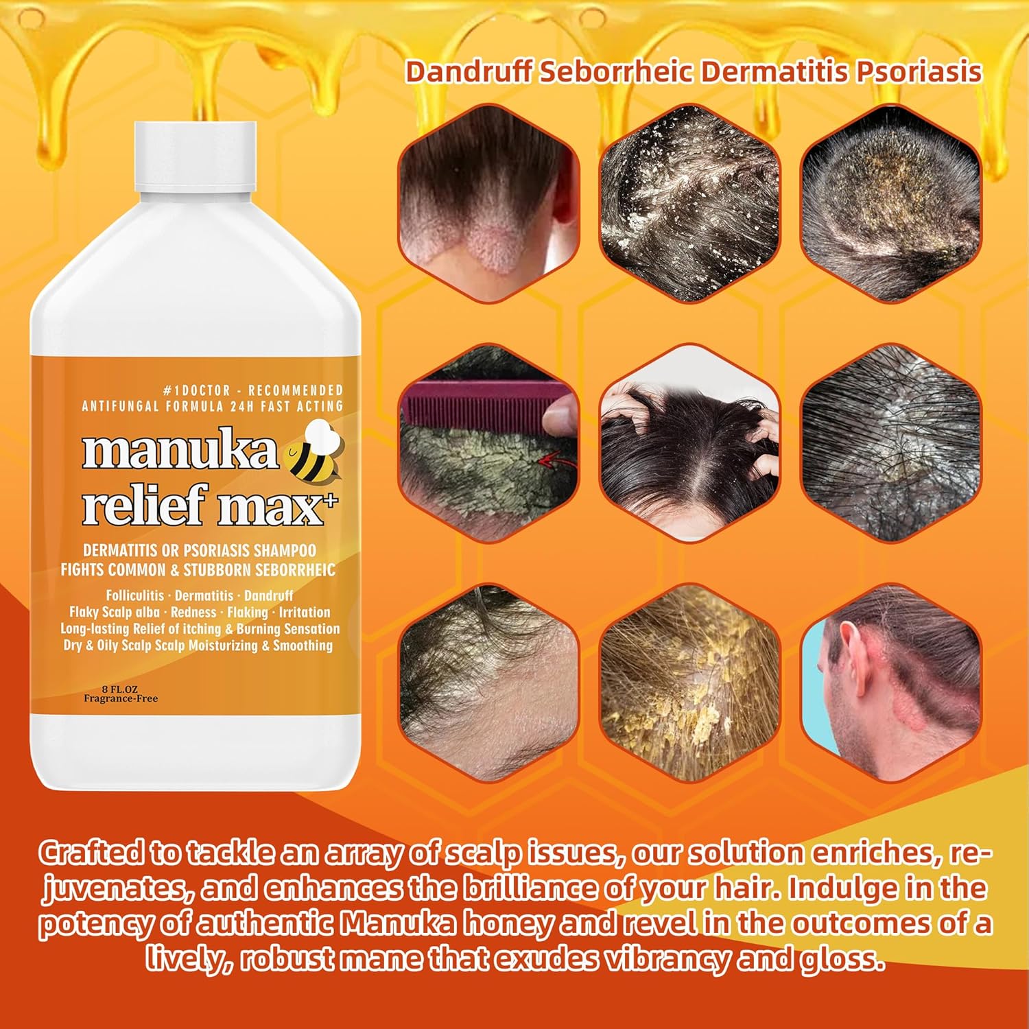10 Pack Manuka Honey Shampoo, Folliculitis Shampoo, Seborrheic Shampoo, AntiDandruff & Shampoo