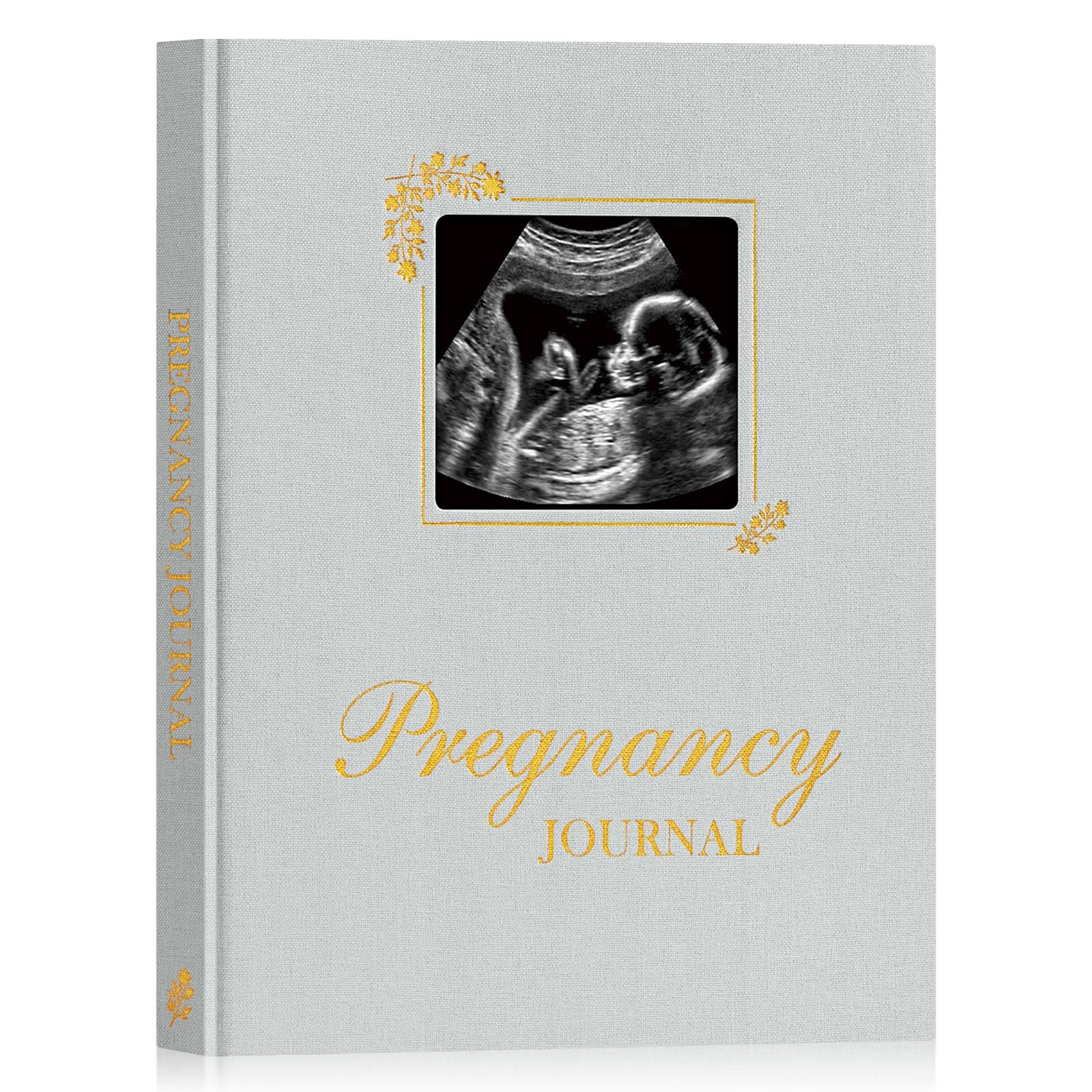 Lanpn My Pregnancy Journal Memory Book for First Time Mom 156 Page Pregnant Announcement Must Have Planner