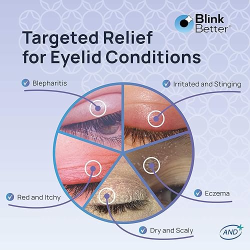 Miniatura 6 de BetterLids ungüento para párpados, complejo intenso de avena con manteca de karité y pantenol, hidrata, nutre y suaviza, cuidado hidratante para