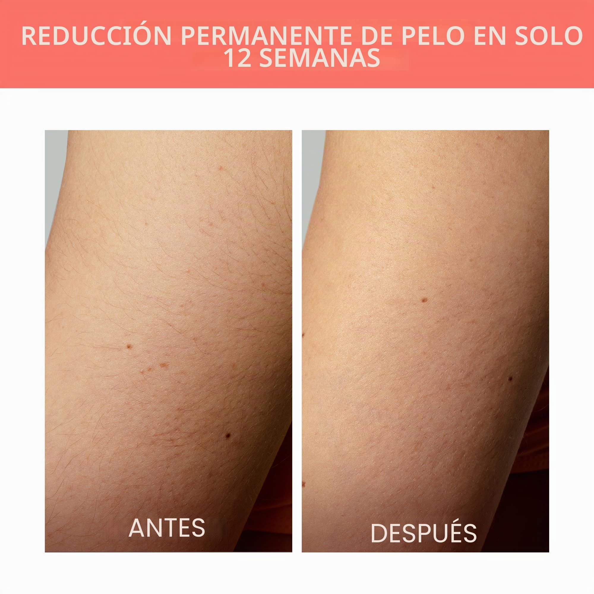 FOREO PEACH 2 GB IPL Depilación definitiva - Depilación definitiva en viaje - Depilación láser - Cuerpo y cara - Rápido - Indolore - Enfriamiento y carcasa de silicona - Coral | Depilación IPL, Depilación láser, IPL de viaje, Depilación bikini, Enfriamien