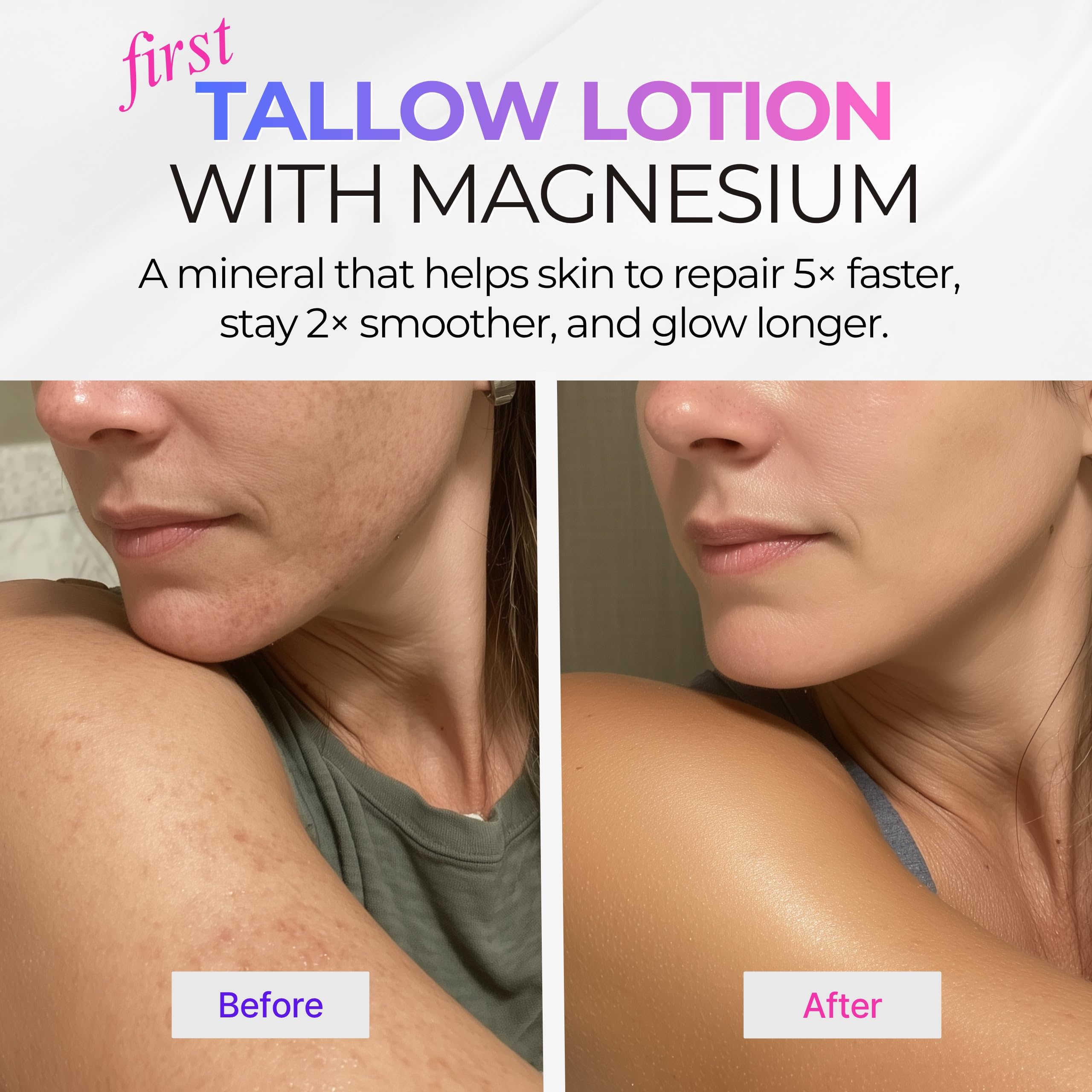 Body Moisturizer for Dry, Sensitive Skin