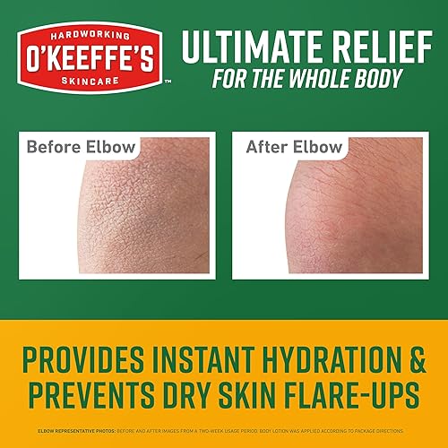 Miniatura 2 de O'Keeffe's Skin Repair Ultimate Relief Crema corporal de 7 onzas (paquete de 1) - para la piel seca más severa