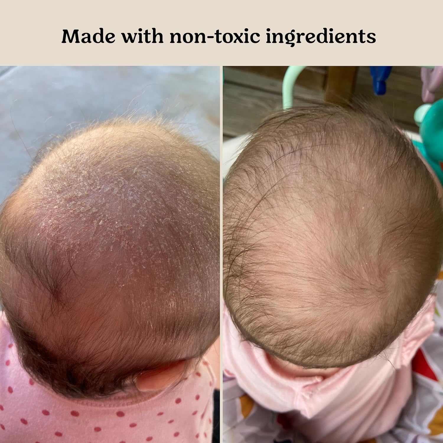 Roe Wellness Baby Hair, Scalp & Body Oil Unscented | Massage, Soothe, & Hydrates Irritated Skin | All Natural Non-Greasy Hydrating | Moisturize Full Body - Image 2