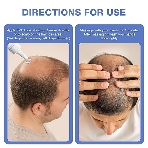 Miniatura 6 de Suero de crecimiento capilar con minoxidil al 5% con biotina para hombres y mujeres, promueve un cabello más grueso y saludable, minoxidil tópico
