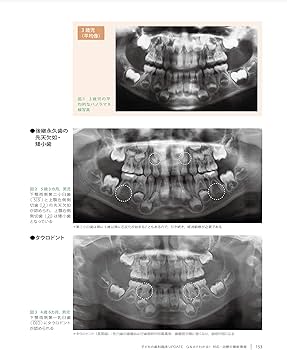 Amazon.com: 歯界展望 別冊 子どもの歯科臨床UPDATE Q&Aでわかる! 対応