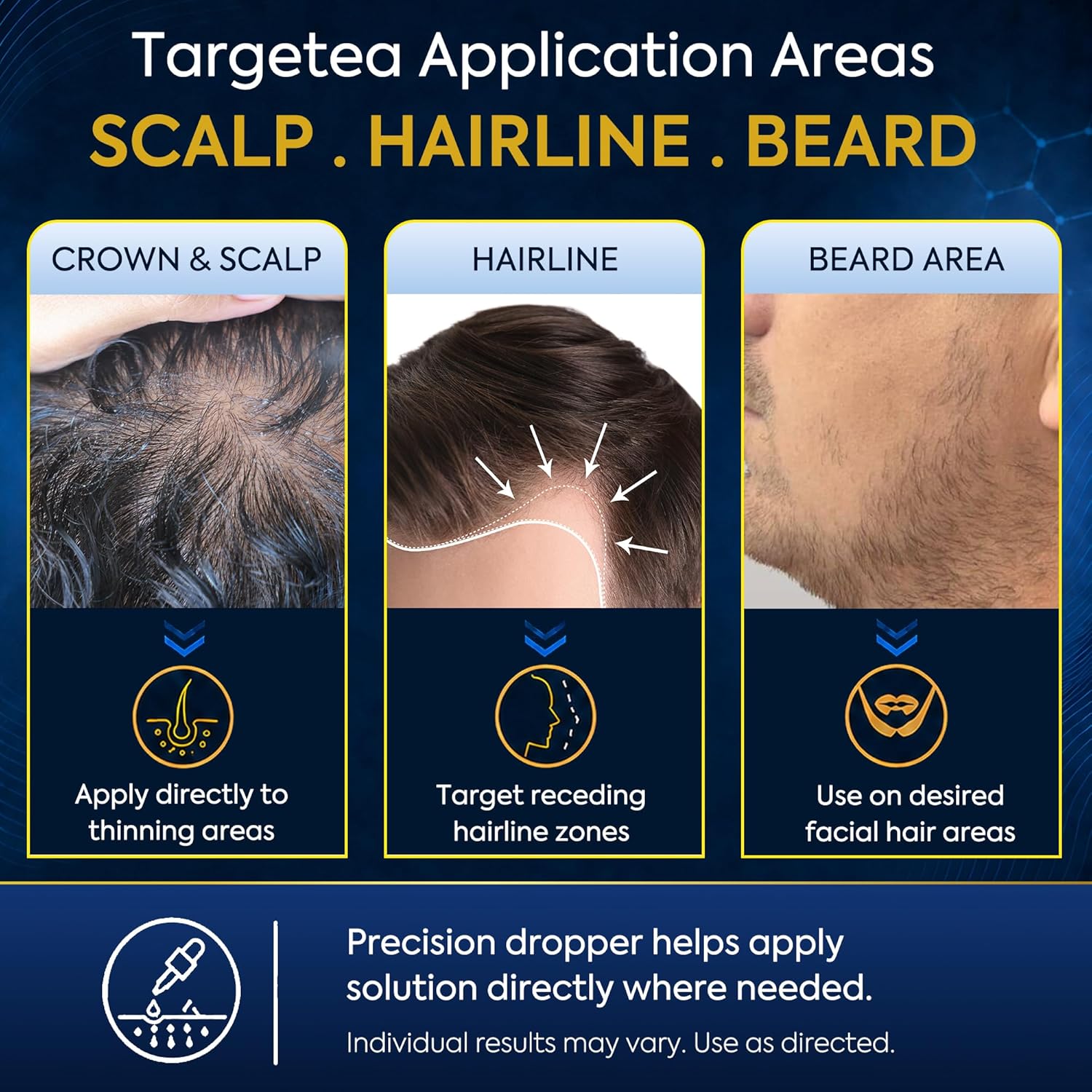 5% Minoxidil for Men Beard Growth Kit: Hair Regrowth Treatment – Hair Growth Serum for Hair Loss & Thinning