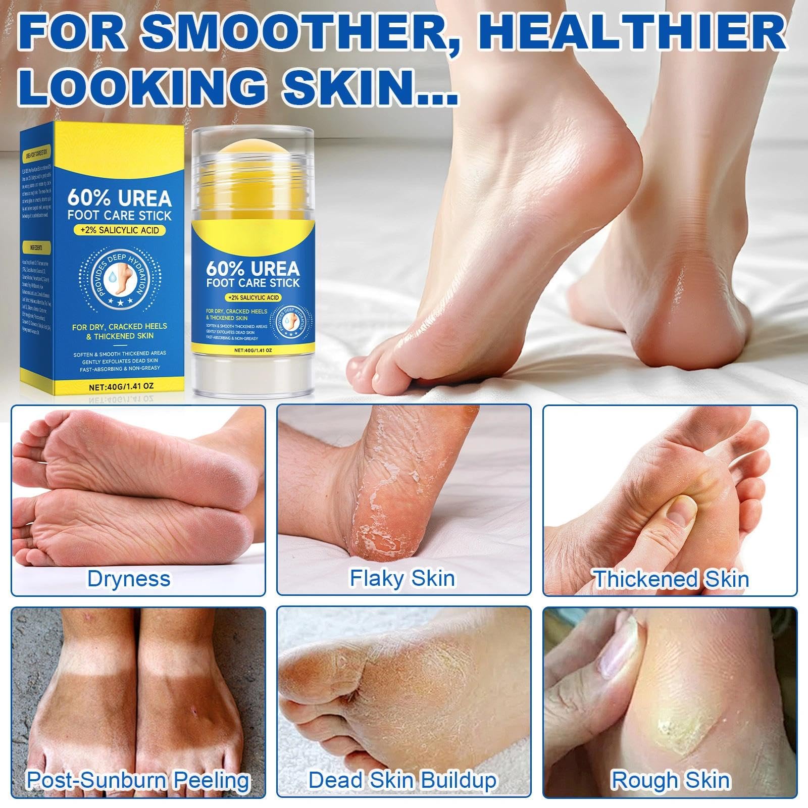 Urea Foot Cream for Cracked Heels and Dry Skin 60 Percent, Cracked Heel Repair Cream, Heel Stick for Soft Smooth Skin - Image 3