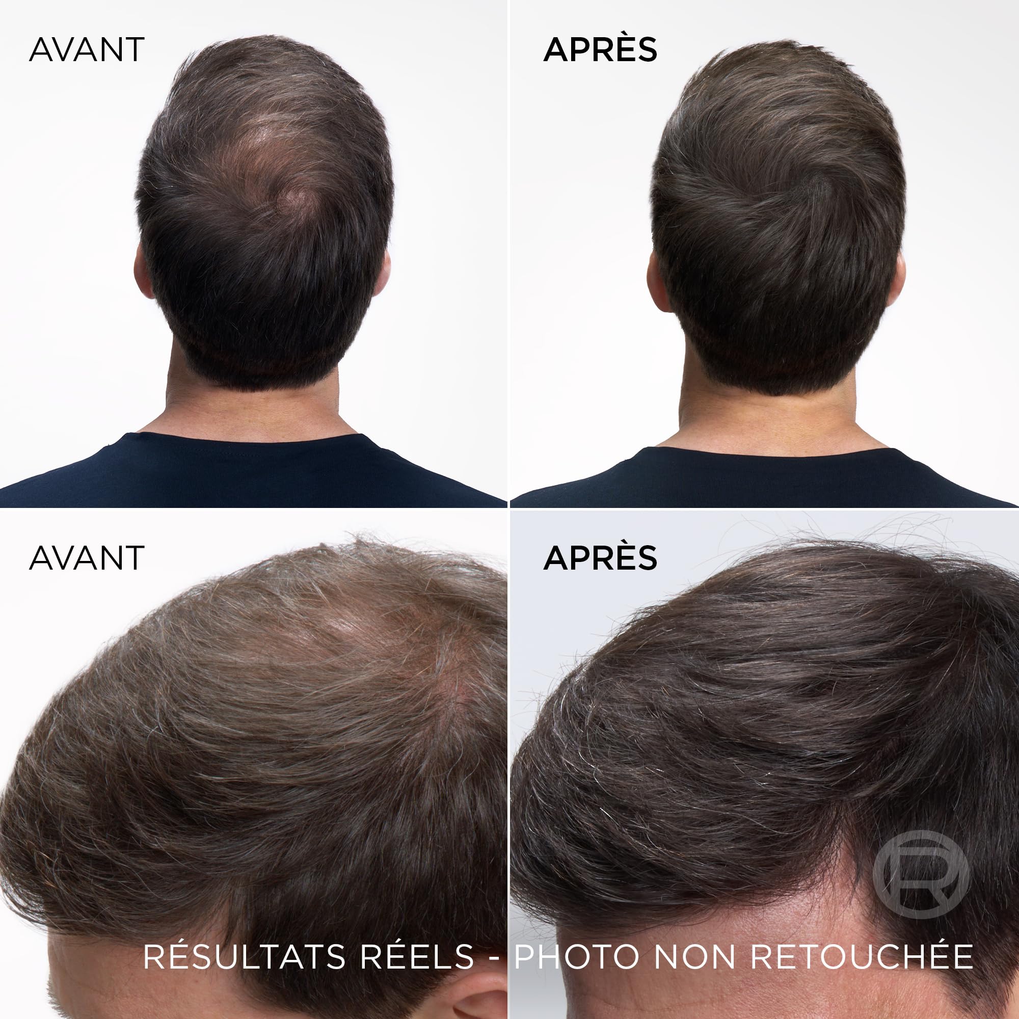 L’ORÉAL PARIS - Spray Instantané Correcteur de Racines & Cheveux Blancs - Hommes & Femmes - Magic Retouch - Châtain Foncé - 2x75ml