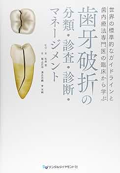 Amazon.co.jp: 歯牙破折の分類・診査・診断・マネージメント