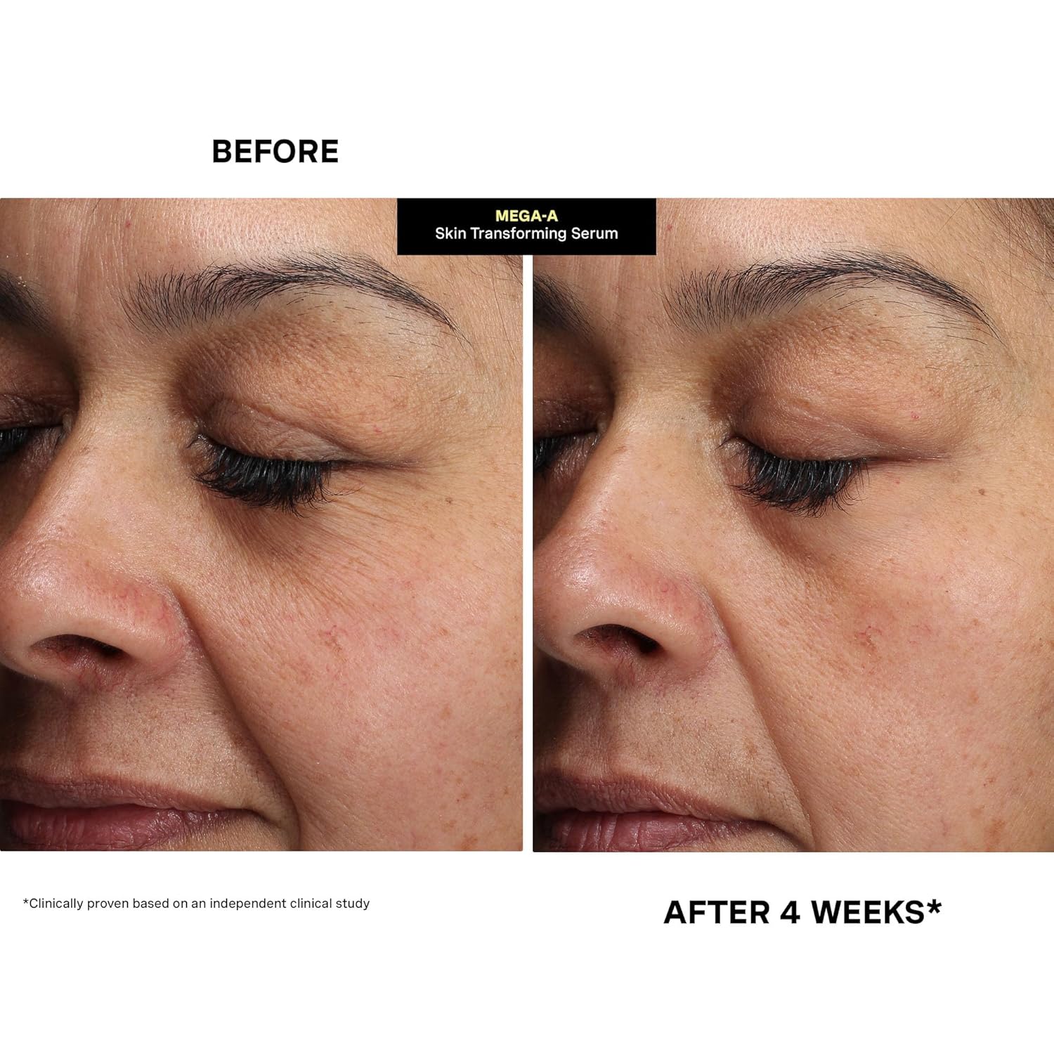 Kate Somerville Mega-A Skin Transforming Serum – Anti-Aging Serum with Hyaluronic Acid For Uneven Texture and Wrinkles, 1 Fl. Oz - Image 8