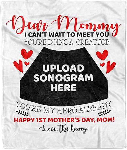 Manta de fotos personalizada con ecografía para padres, manta de ultrasonido para primera vez, mamá y papá, imagen de ecograma personalizada única