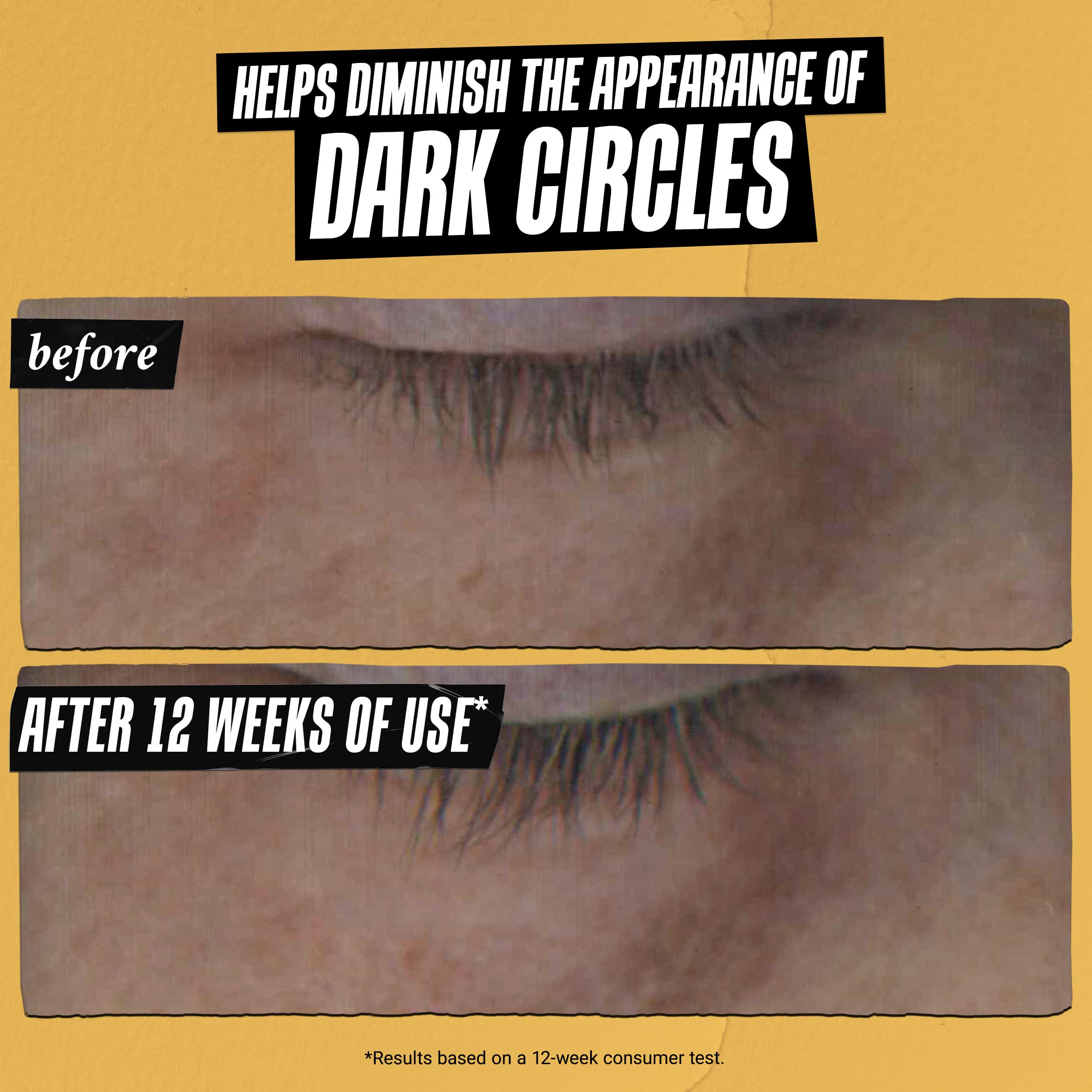 Kiehl's Kiehl's Powerful-Strength serum do oczu z witaminą C, redukcja linii i cienie pod oczami