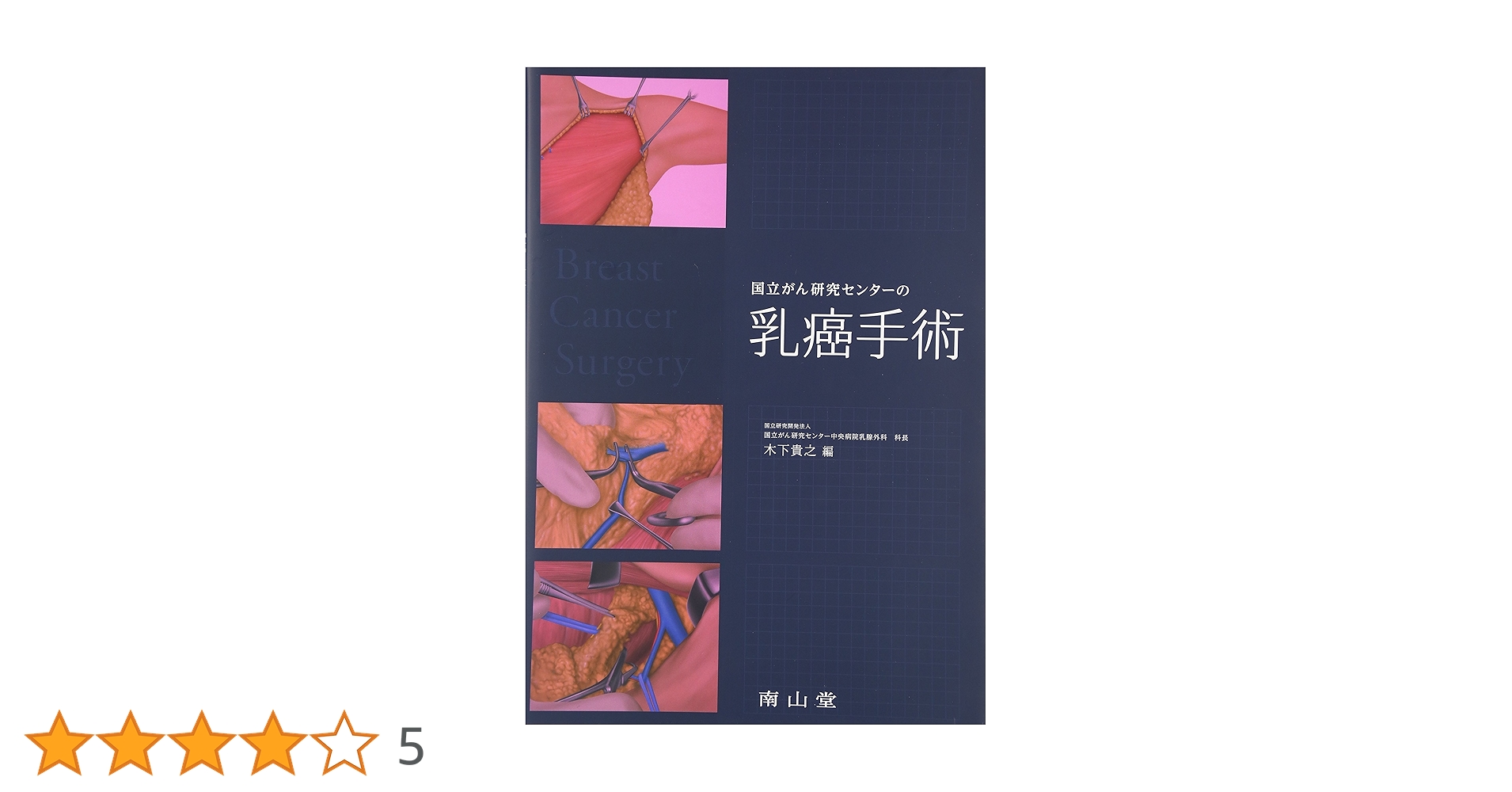 国立がん研究センターの乳癌手術　美容外科基本手術　適応と術式 Amazon.co.jp: 国立がん研究センターの乳癌手術 : 木下貴之: 本