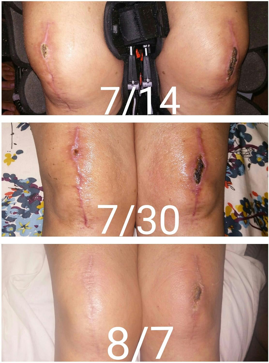 Jenny Joy's Made in USA- Pinon Pine Salve 4 oz Naturally Soothing Balm of Southwest.Healing Salve for Dry Skin Irritations, Lip Balm, Cracked Hands and Feet and Skin Repair (Eucalyptus, 4 oz)