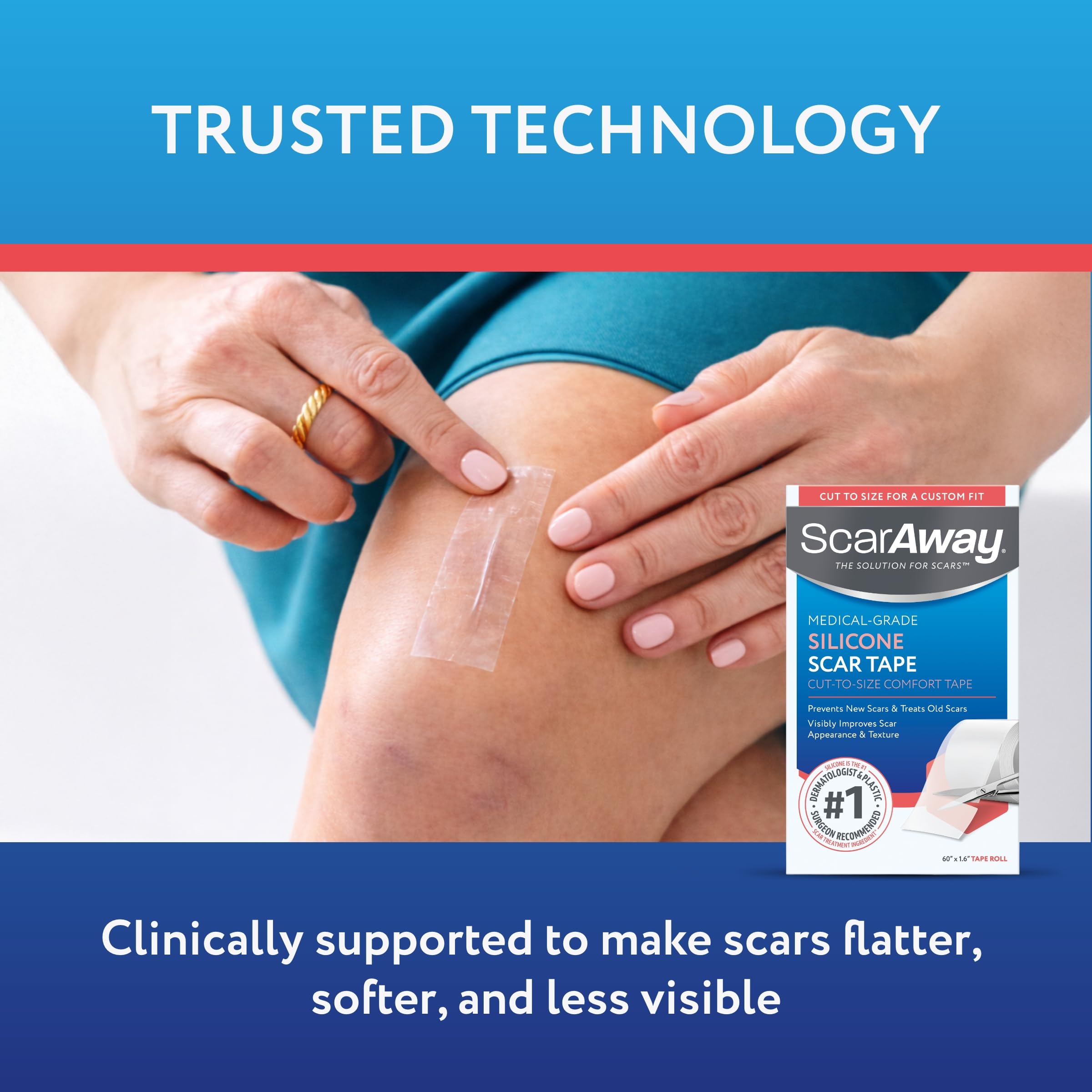 ScarAway Silicone Scar Tape - Reduce Scar Appearance -5