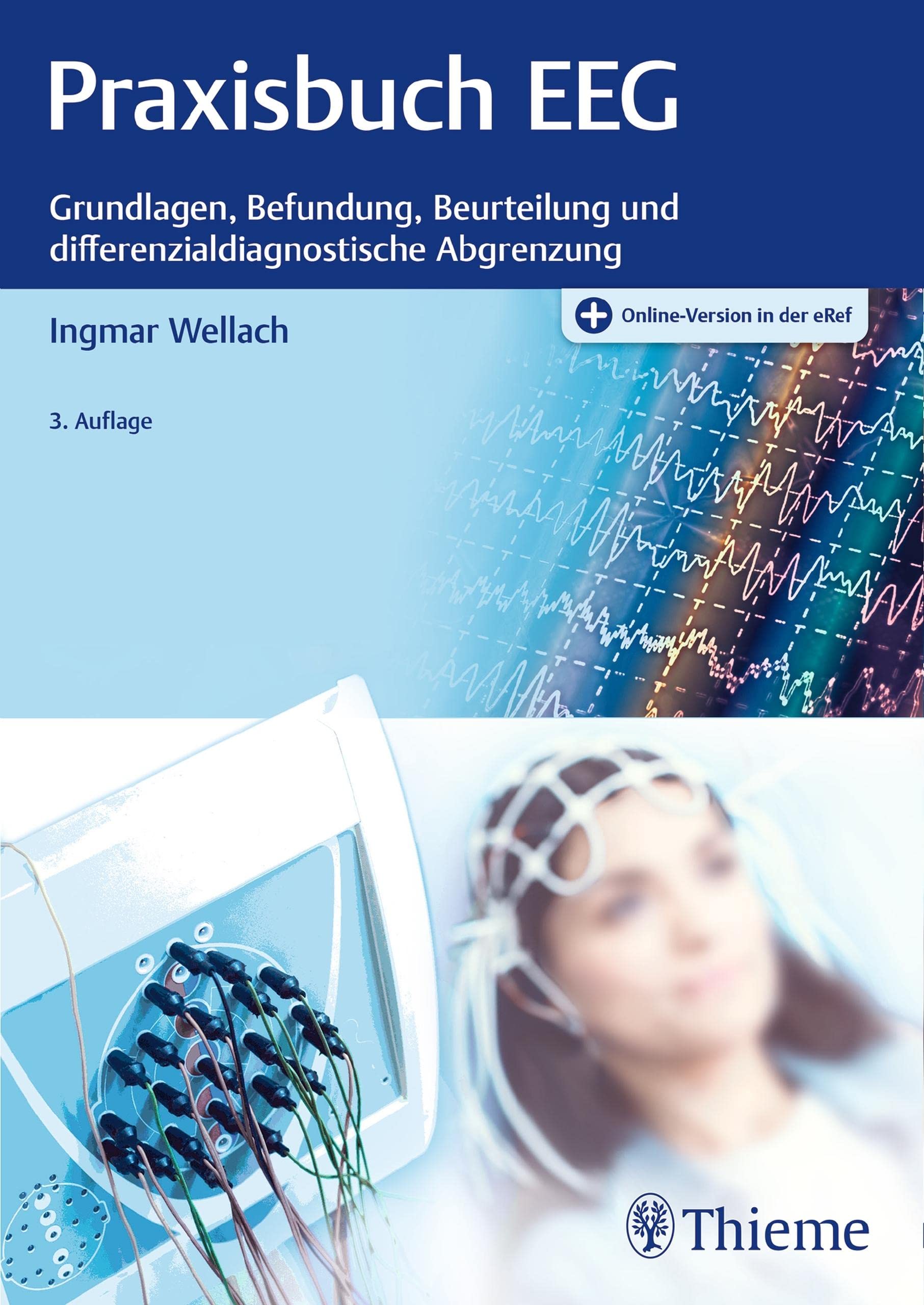 Praxisbuch EEG: Grundlagen, Befundung, Beurteilung und differenzialdiagnostische Abgrenzung (German Edition)